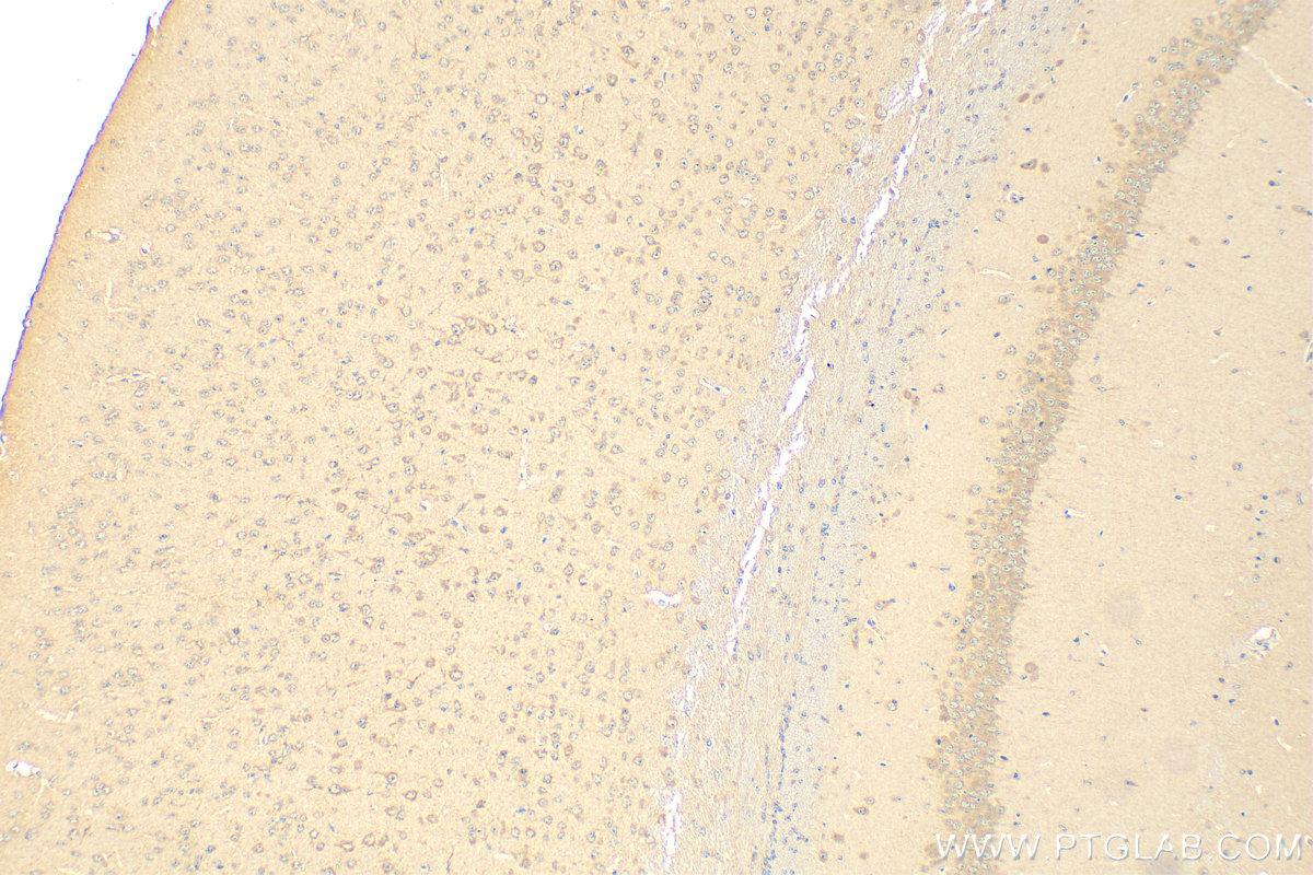 Immunohistochemistry (IHC) staining of mouse brain tissue using AFM Monoclonal antibody (66113-1-Ig)