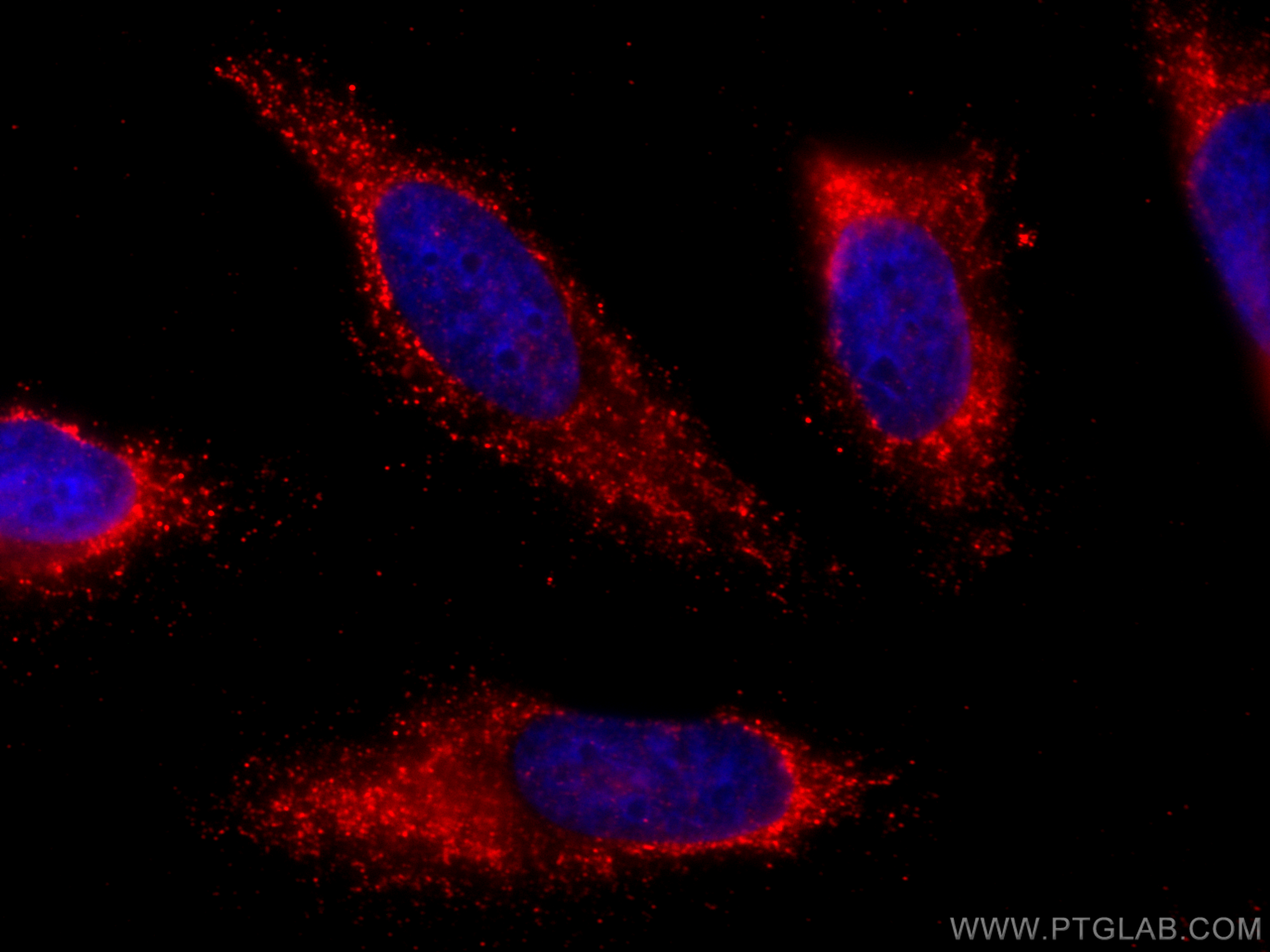 Immunofluorescence (IF) / fluorescent staining of HeLa cells using CoraLite®594-conjugated AFM Monoclonal antibody (CL594-66113)