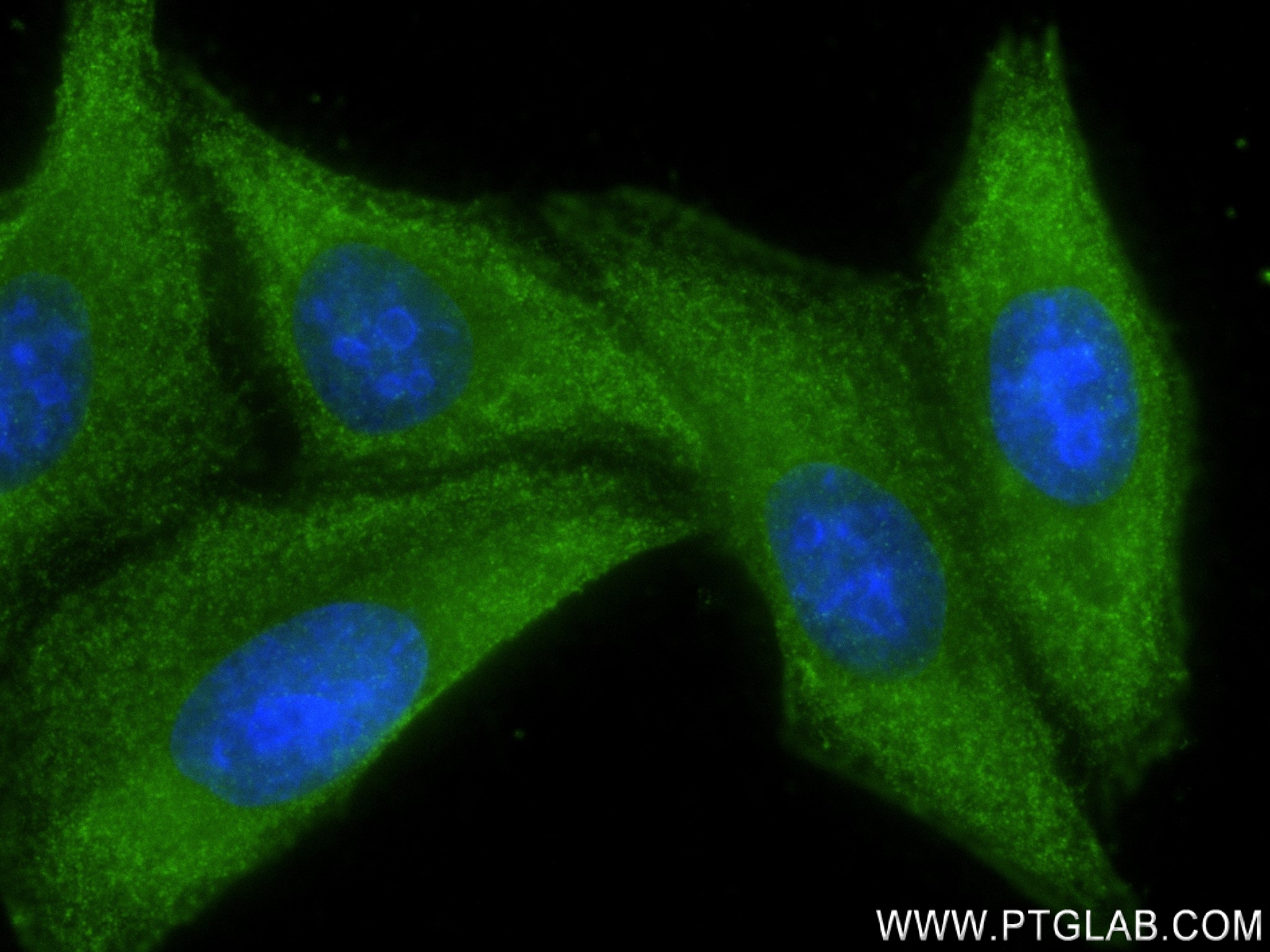 Immunofluorescence (IF) / fluorescent staining of HepG2 cells using AFP Recombinant antibody (82982-5-RR)