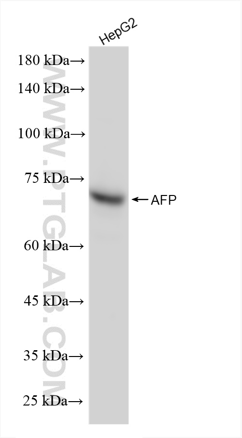 Western Blot (WB) analysis of HepG2 cells using AFP Recombinant antibody (82982-5-RR)