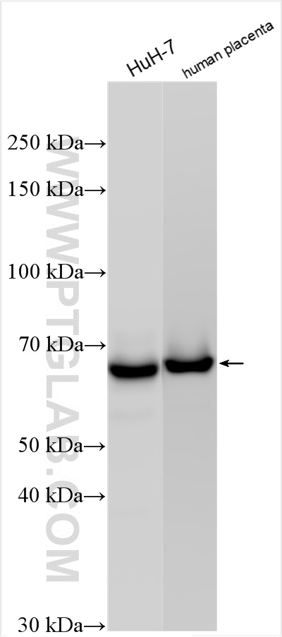 Western Blot (WB) analysis of various lysates using AFP Recombinant antibody (82982-5-RR)