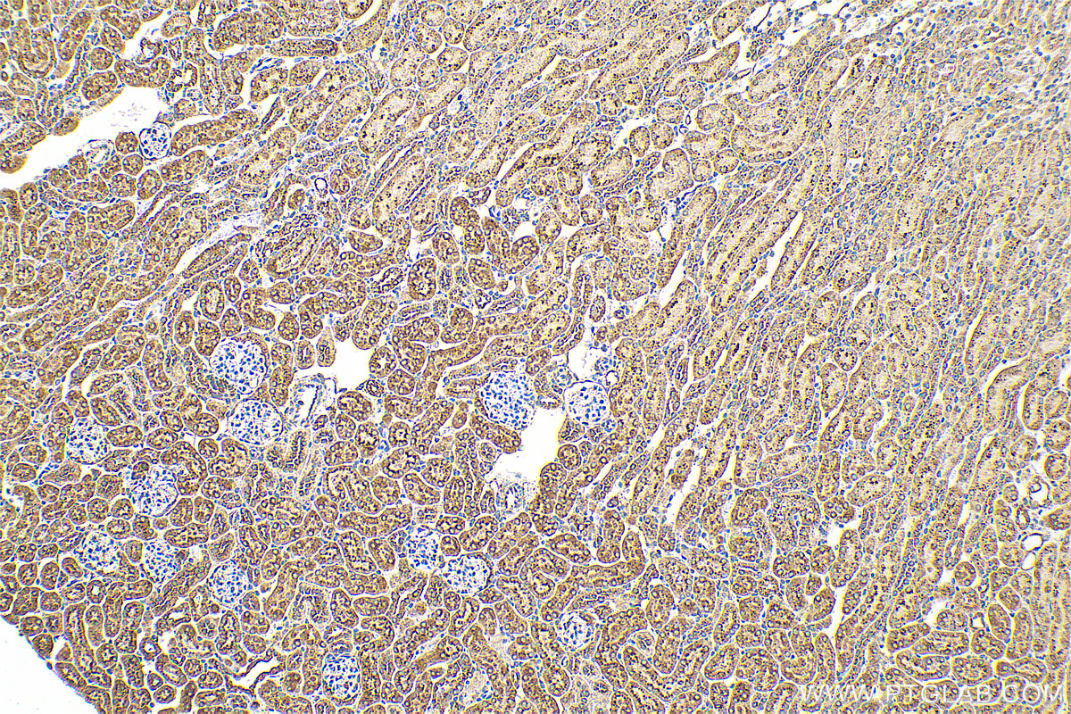 Immunohistochemistry (IHC) staining of mouse kidney tissue using AGA Polyclonal antibody (17299-1-AP)