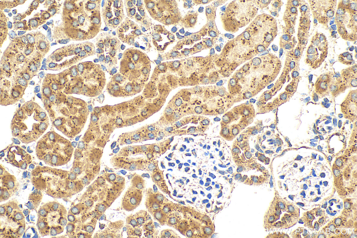 Immunohistochemistry (IHC) staining of mouse kidney tissue using AGA Polyclonal antibody (17299-1-AP)