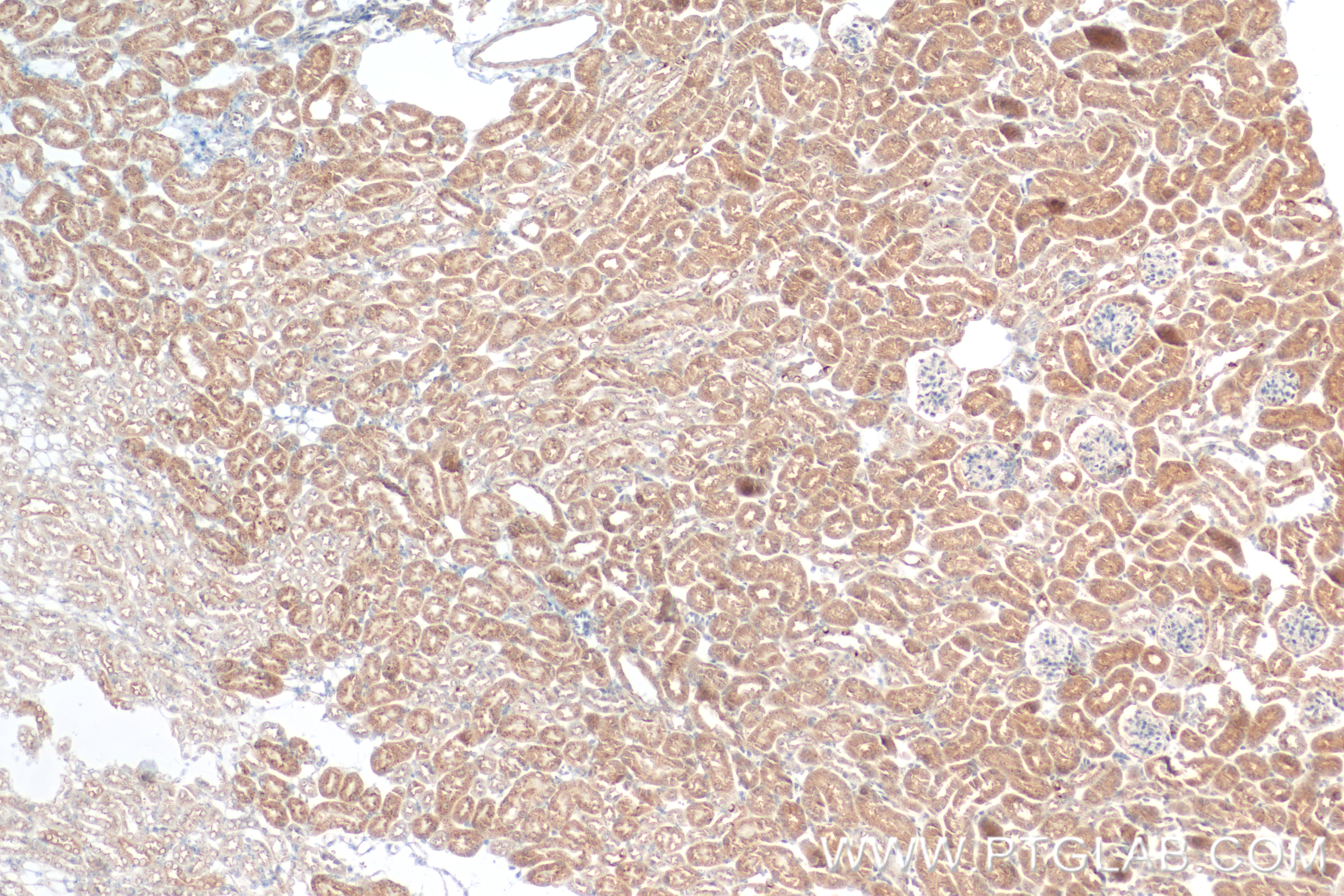 Immunohistochemistry (IHC) staining of mouse kidney tissue using AGA Recombinant antibody (83442-6-RR)