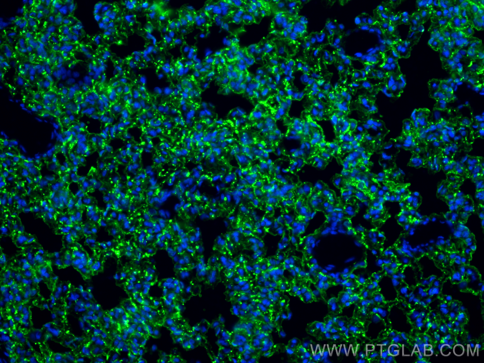 Immunofluorescence (IF) / fluorescent staining of rat lung tissue using AGER/RAGE Monoclonal antibody (66833-1-Ig)