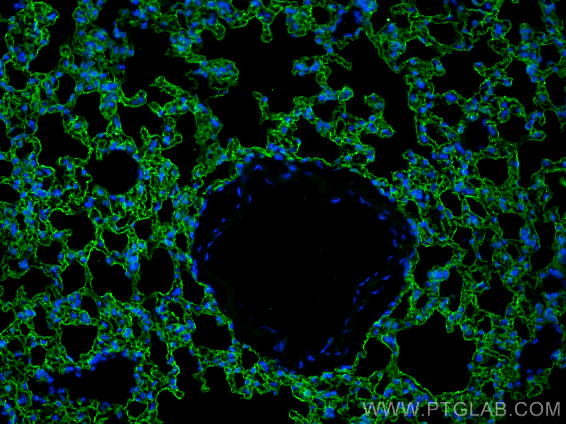 Immunofluorescence (IF) / fluorescent staining of mouse lung tissue using AGER/RAGE Monoclonal antibody (66833-1-Ig)