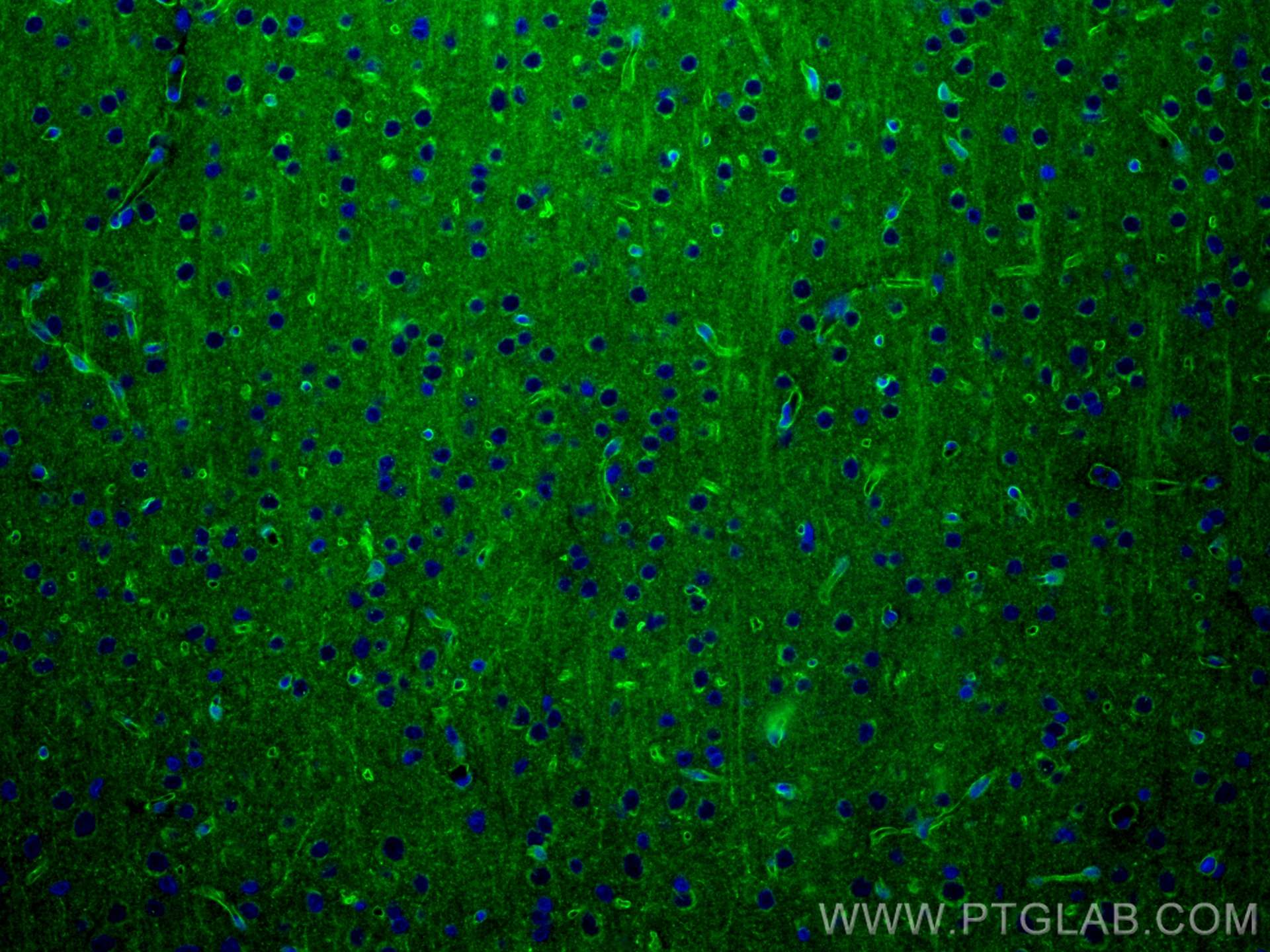 Immunofluorescence (IF) / fluorescent staining of rat brain tissue using AGER/RAGE Recombinant antibody (83759-4-RR)