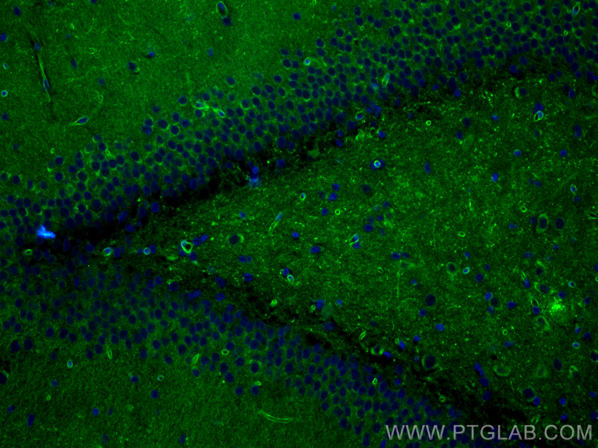 Immunofluorescence (IF) / fluorescent staining of rat brain tissue using AGER/RAGE Recombinant antibody (83759-4-RR)