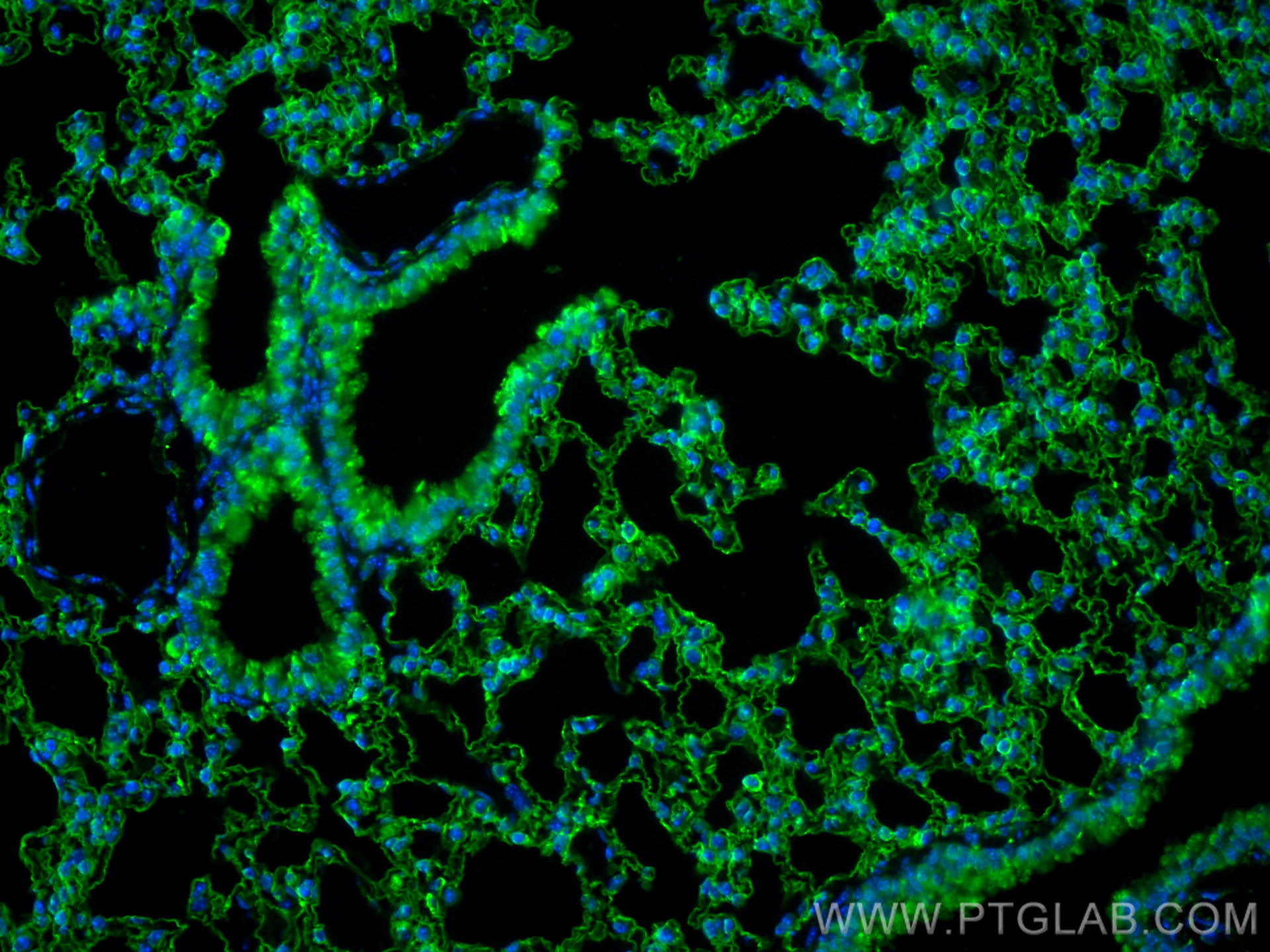 Immunofluorescence (IF) / fluorescent staining of mouse lung tissue using CoraLite® Plus 488-conjugated AGER/RAGE Monoclonal (CL488-66833)