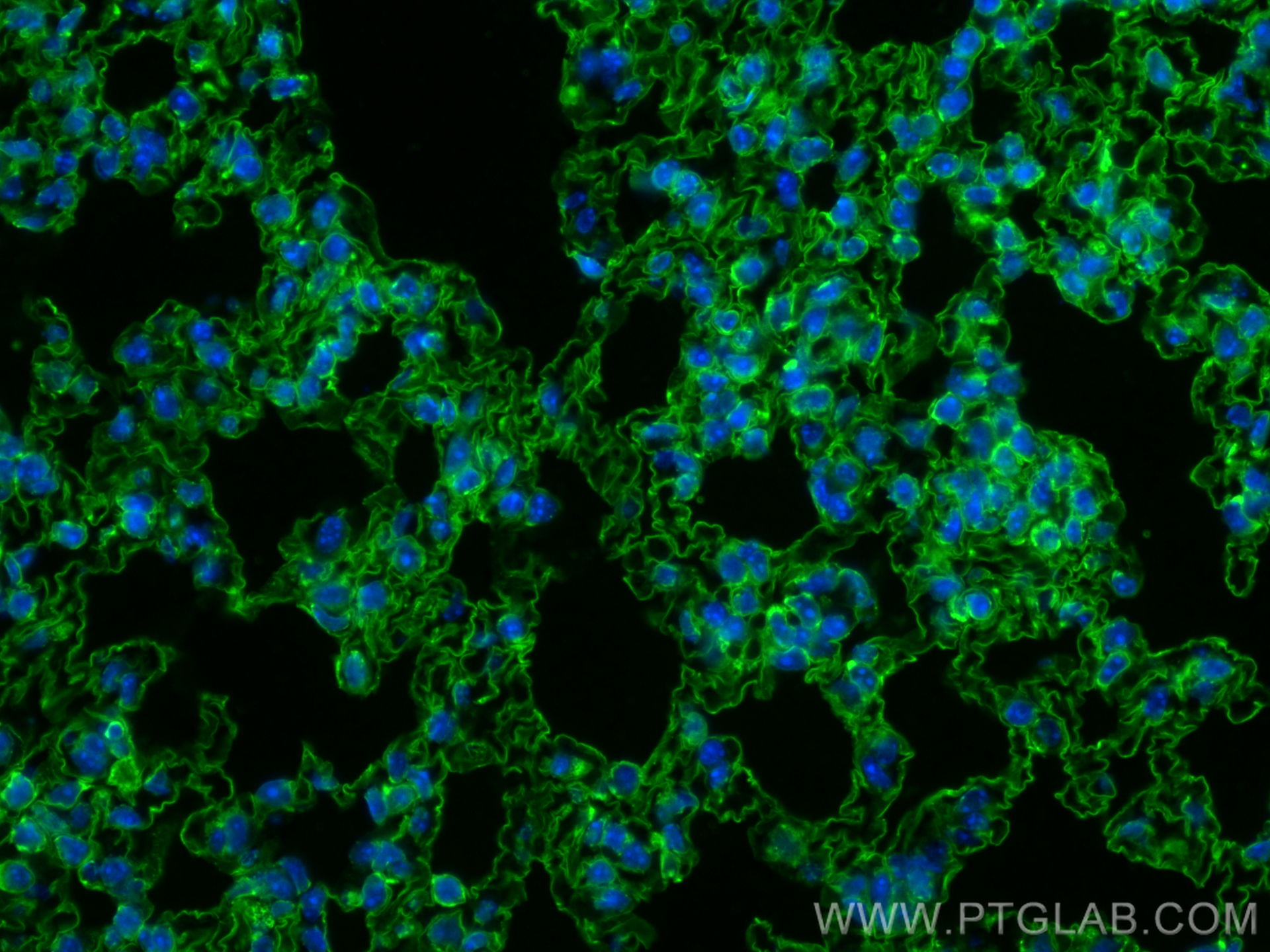 Immunofluorescence (IF) / fluorescent staining of mouse lung tissue using CoraLite® Plus 488-conjugated AGER/RAGE Monoclonal (CL488-66833)
