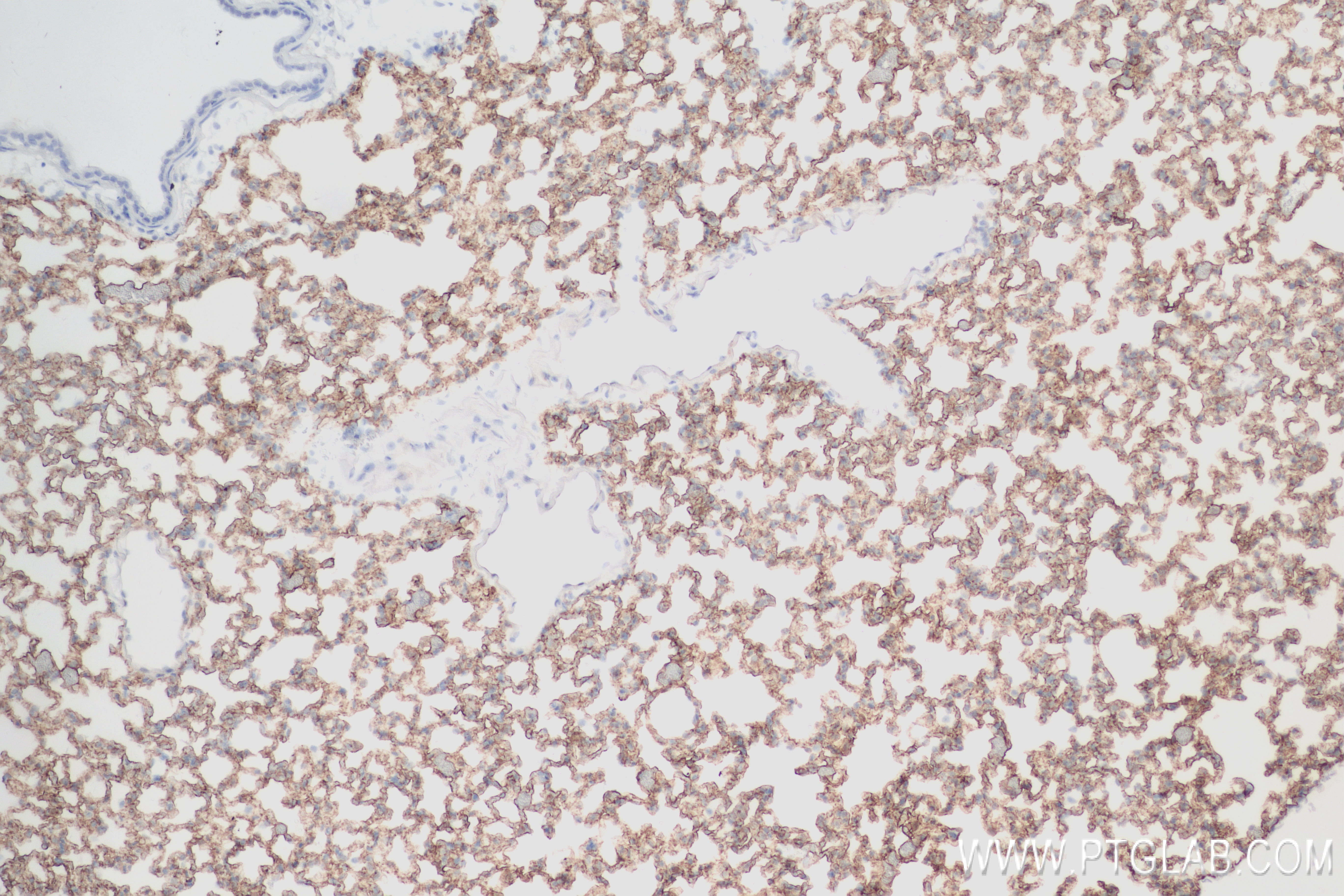 Immunohistochemistry (IHC) staining of mouse lung tissue using AGER/RAGE Recombinant antibody (83759-5-RR)