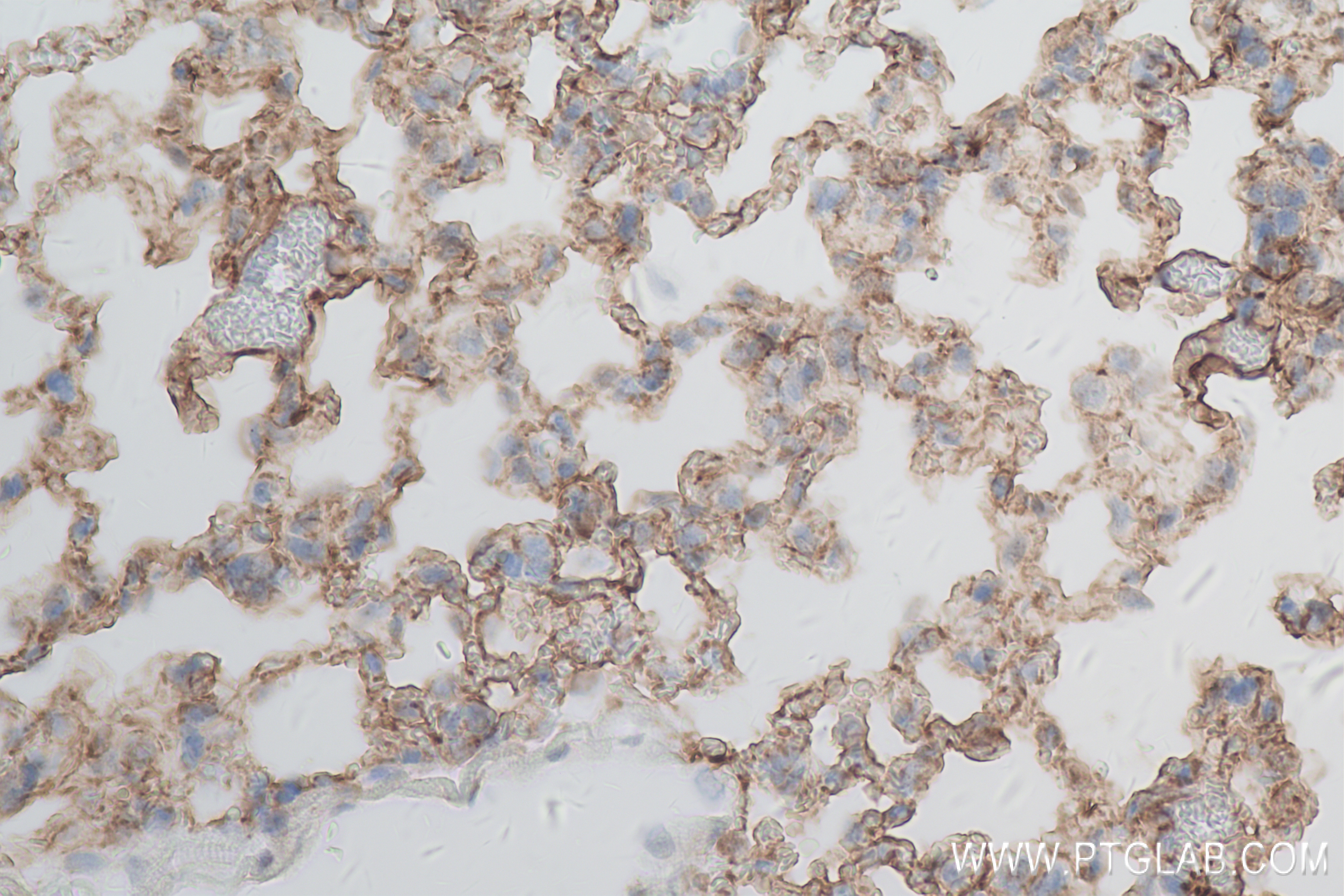 Immunohistochemistry (IHC) staining of mouse lung tissue using AGER/RAGE Recombinant antibody (83759-5-RR)