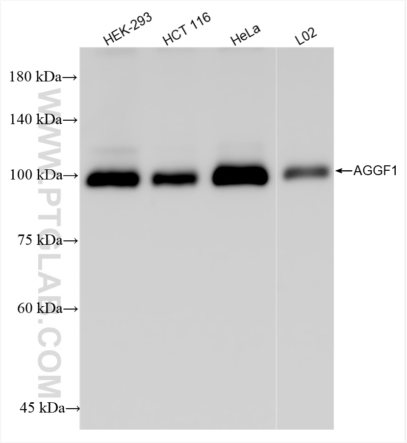 Western Blot (WB) analysis of various lysates using AGGF1 Recombinant antibody (84715-3-RR)