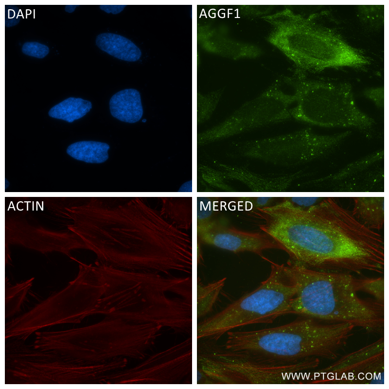 Immunofluorescence (IF) / fluorescent staining of HeLa cells using AGGF1 Recombinant antibody (84715-4-RR)