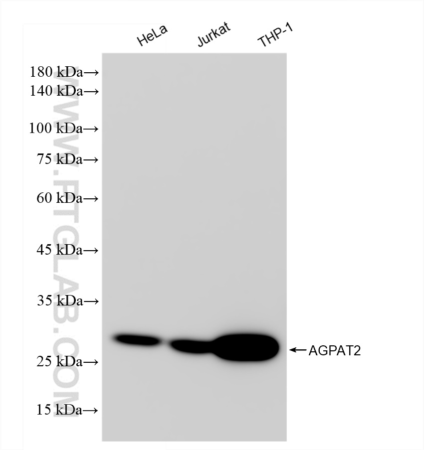 Western Blot (WB) analysis of various lysates using AGPAT2 Recombinant antibody (83349-3-RR)