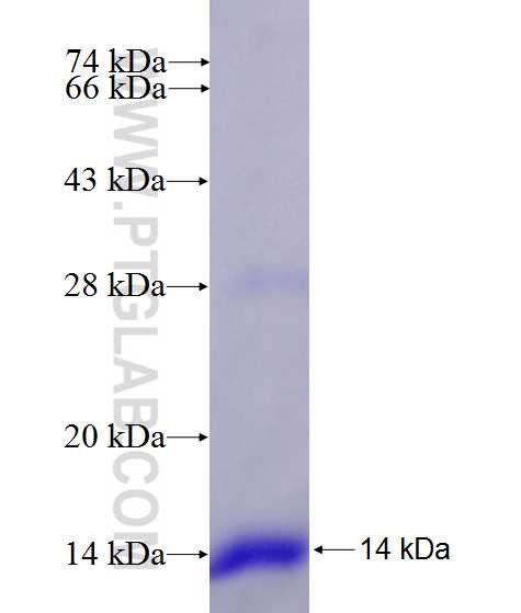 AGPAT2 fusion protein Ag27907 SDS-PAGE