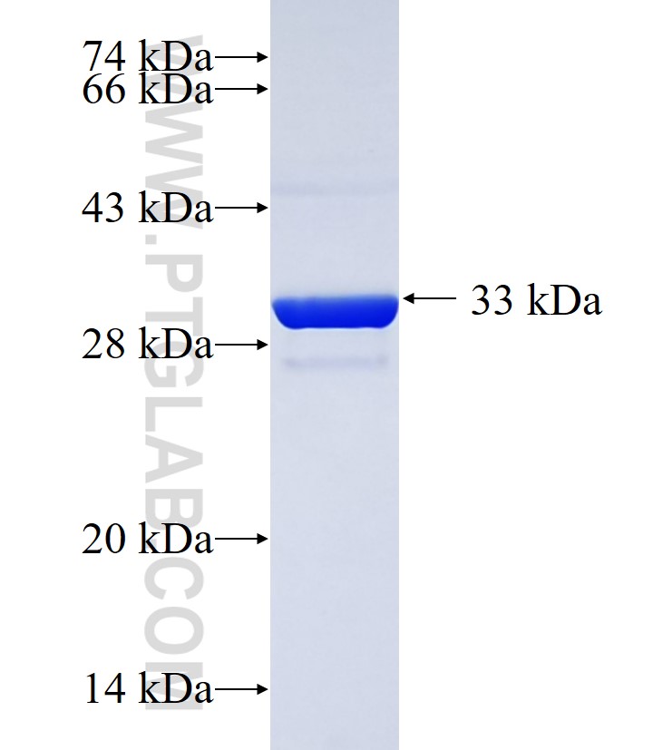 AGPAT2 fusion protein Ag34761 SDS-PAGE