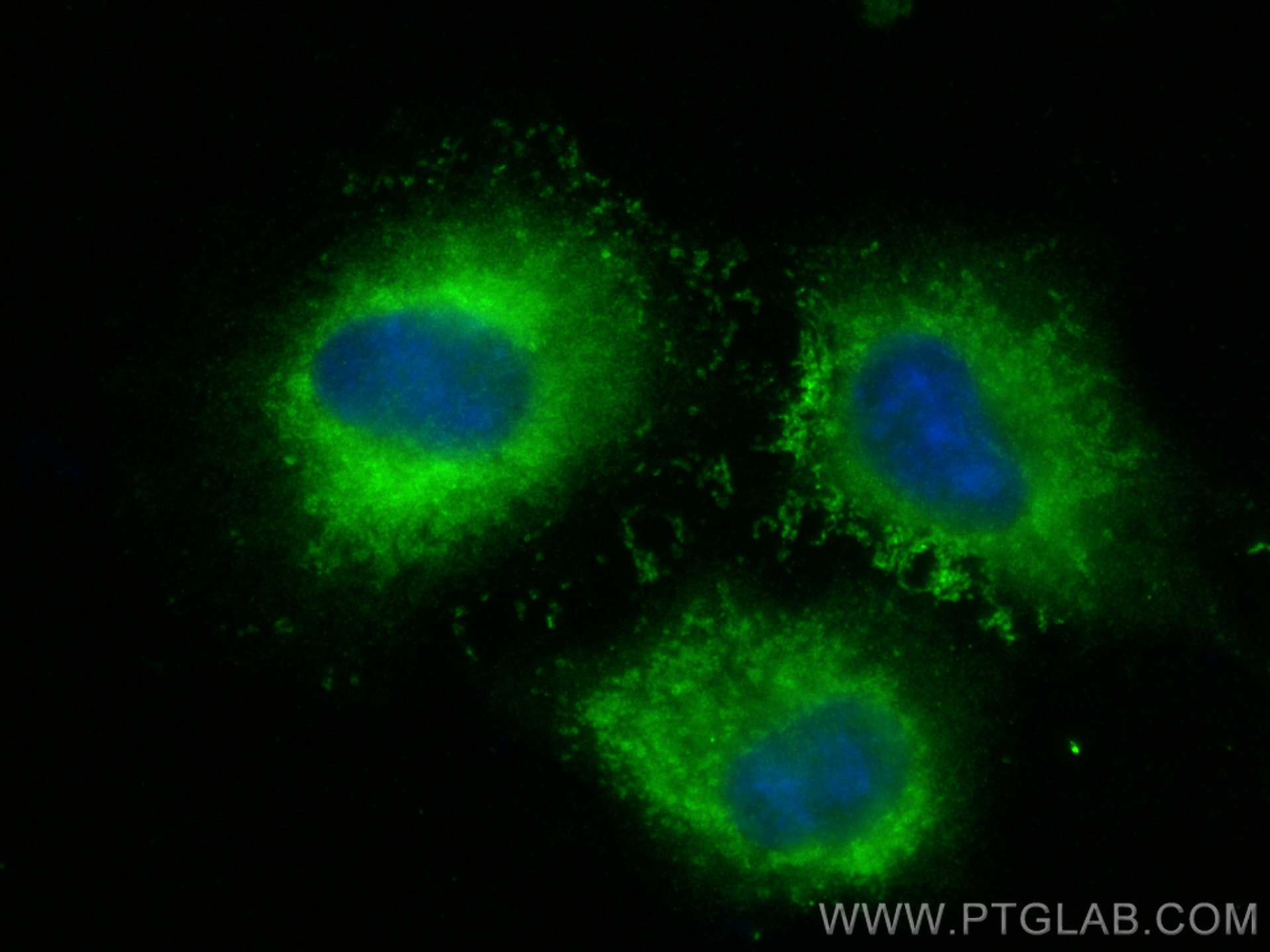 Immunofluorescence (IF) / fluorescent staining of A549 cells using AGR2 Polyclonal antibody (12275-1-AP)