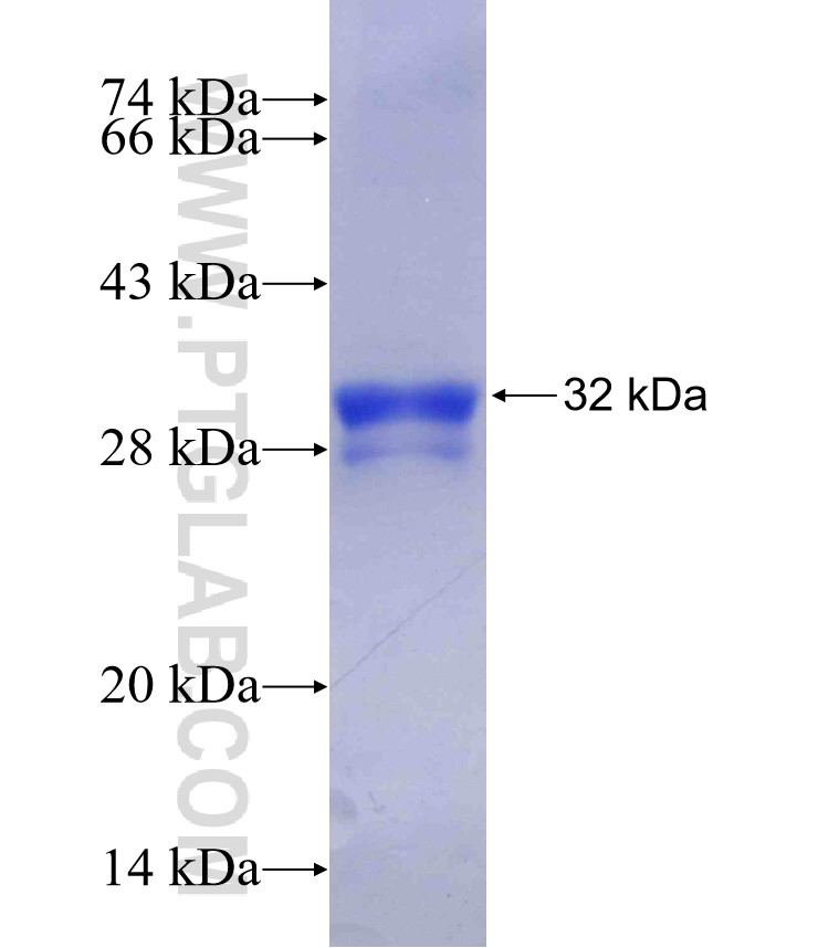 AGRP fusion protein Ag29389 SDS-PAGE