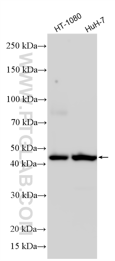 Western Blot (WB) analysis of various lysates using AGTR1 Polyclonal antibody (25343-1-AP)