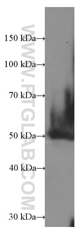 Western Blot (WB) analysis of rat heart tissue using AGTR1 Monoclonal antibody (66415-1-Ig)