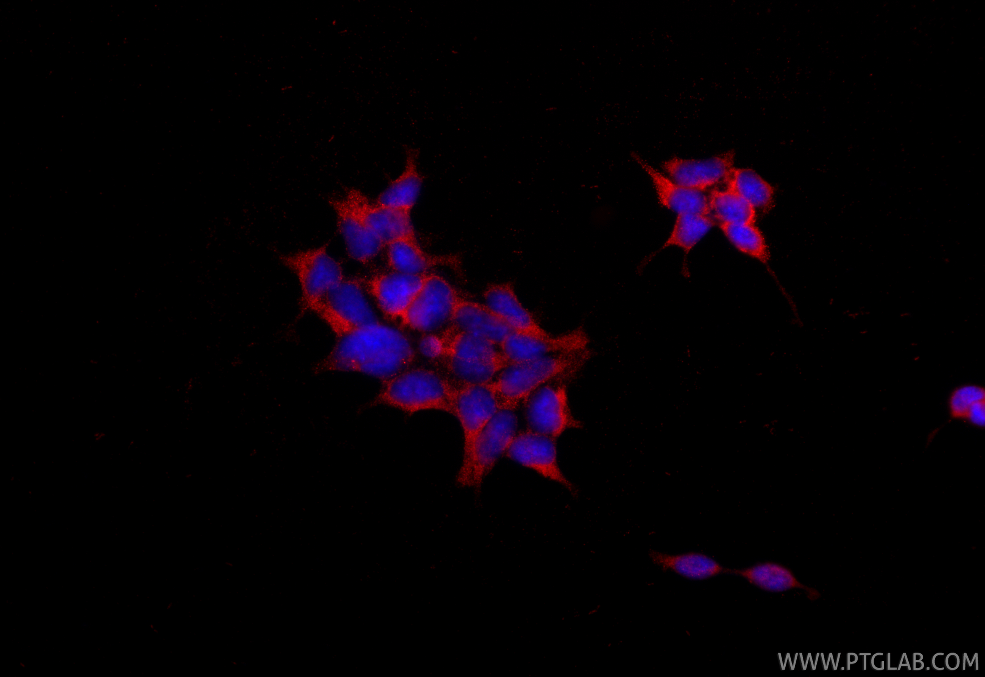 Immunofluorescence (IF) / fluorescent staining of HEK-293 cells using AGTR2 Polyclonal antibody (30963-1-AP)