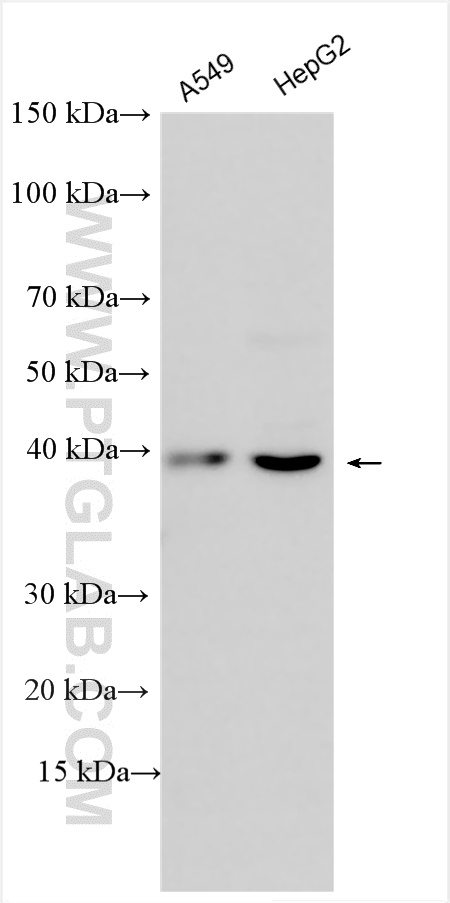 Western Blot (WB) analysis of various lysates using AGTR2 Polyclonal antibody (30963-1-AP)