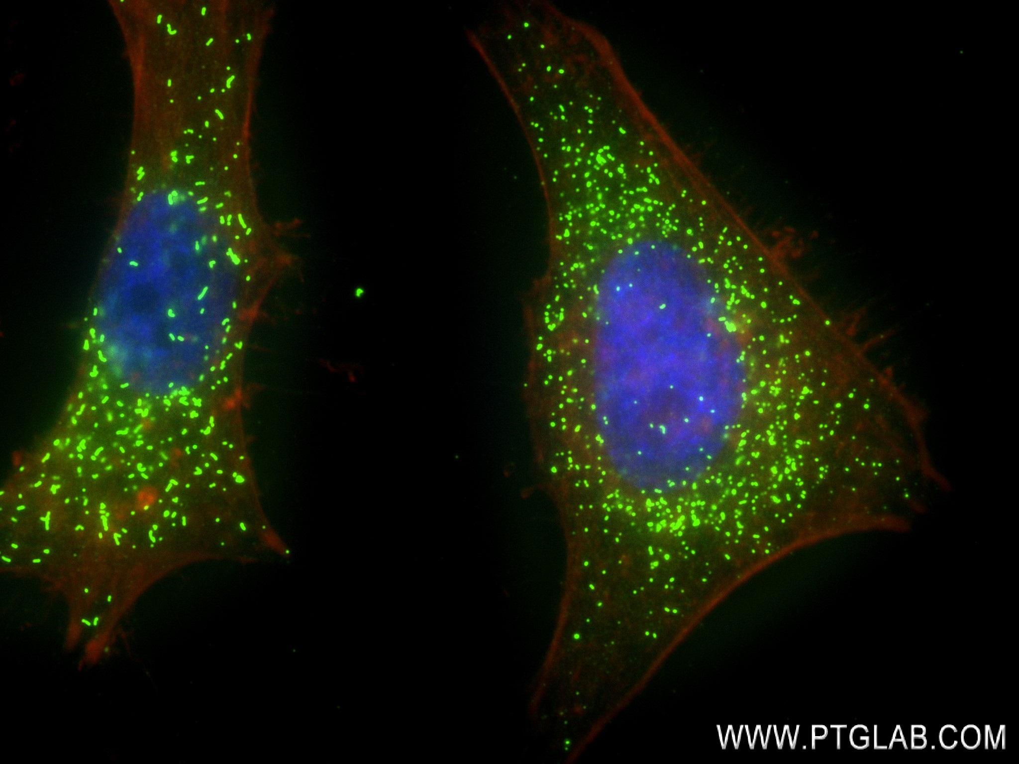 Immunofluorescence (IF) / fluorescent staining of HeLa cells using AGXT Recombinant antibody (83385-6-RR)