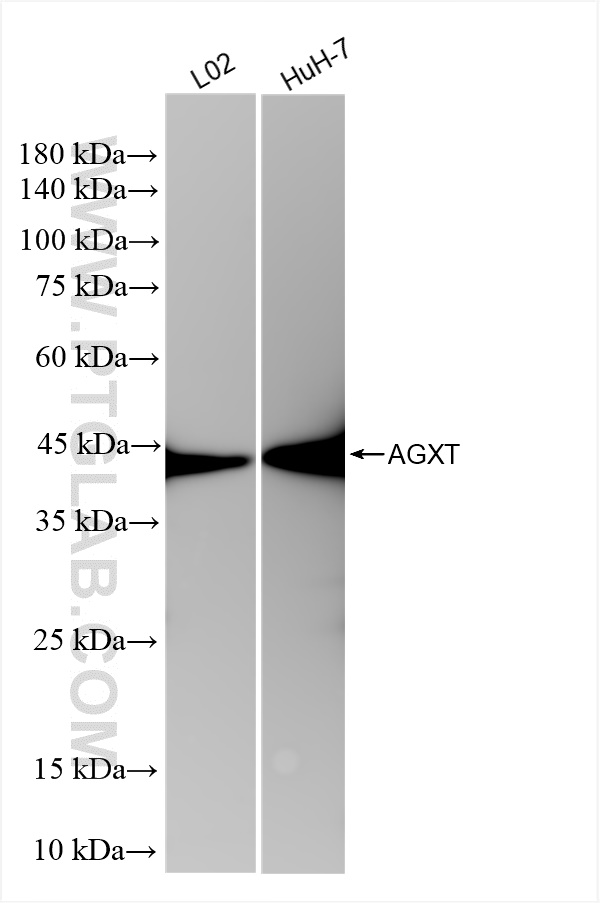 Western Blot (WB) analysis of various lysates using AGXT Recombinant antibody (83385-6-RR)