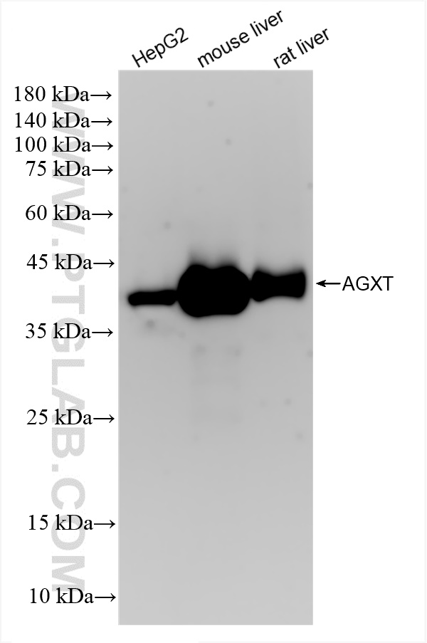 Western Blot (WB) analysis of various lysates using AGXT Recombinant antibody (83385-6-RR)