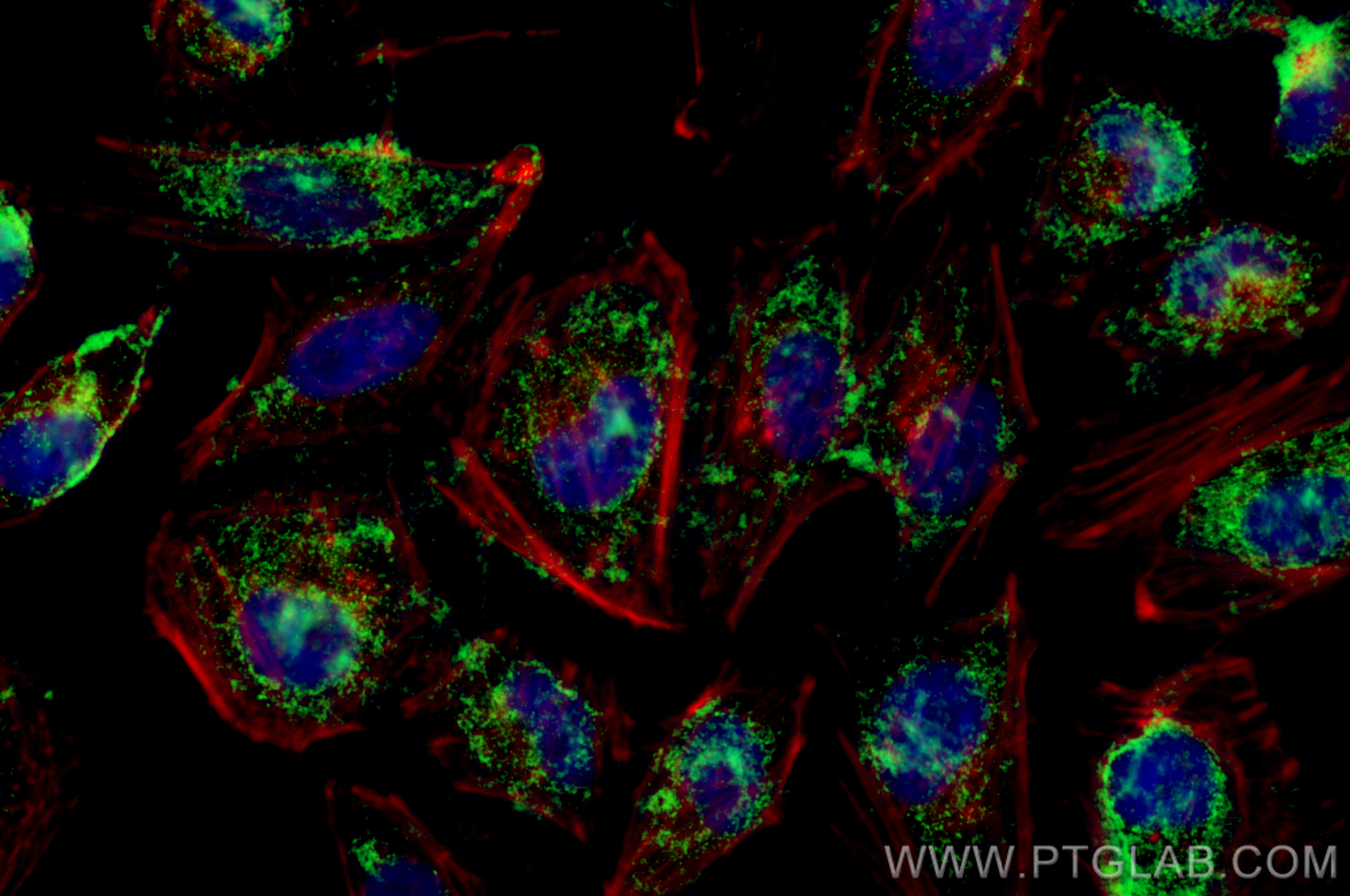 Immunofluorescence (IF) / fluorescent staining of HeLa cells using CoraLite® Plus 488-conjugated AGXT Recombinant ant (CL488-83385-6)