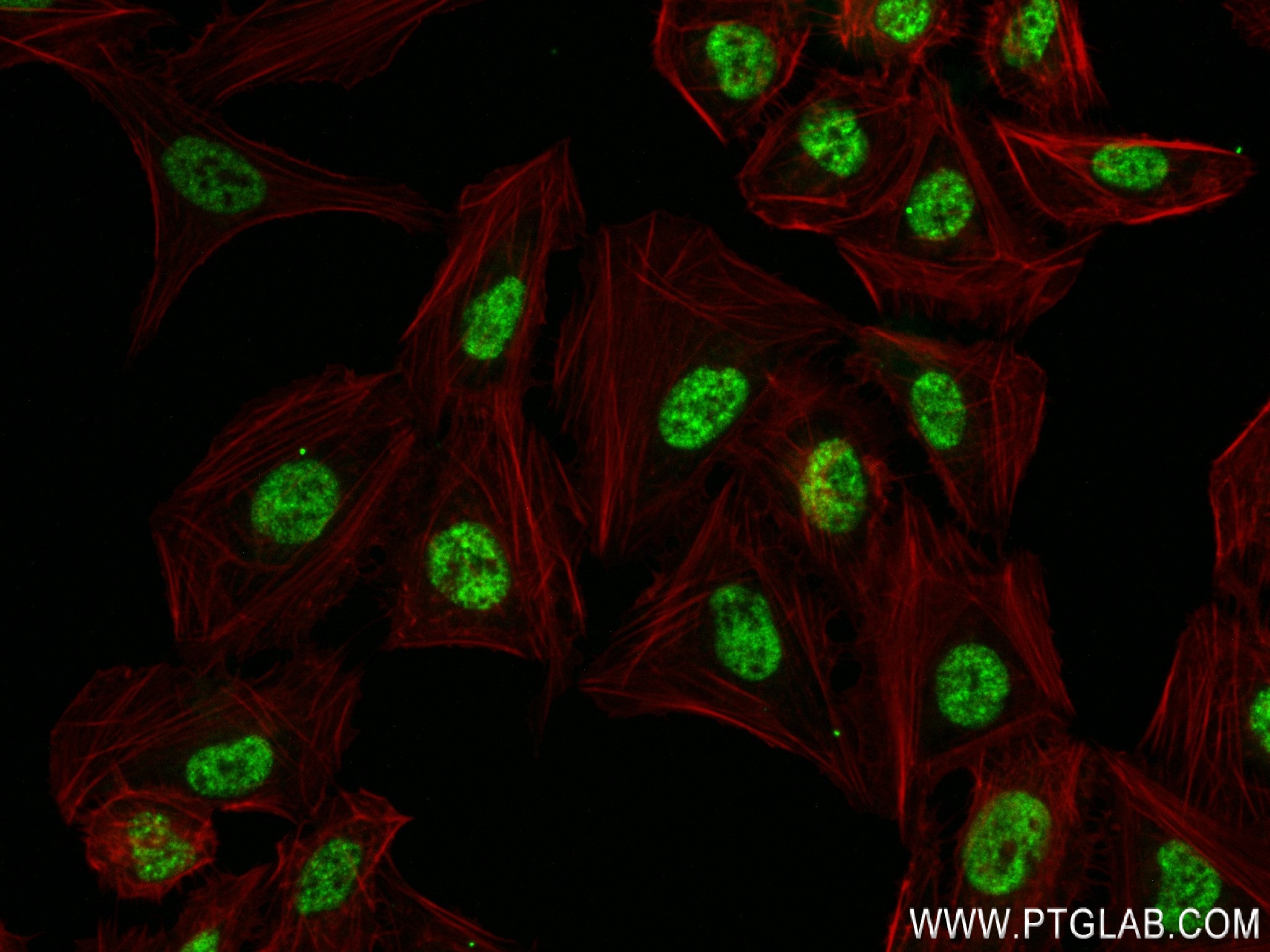 Immunofluorescence (IF) / fluorescent staining of U2OS cells using AGXT2L1 Recombinant antibody (83984-5-RR)