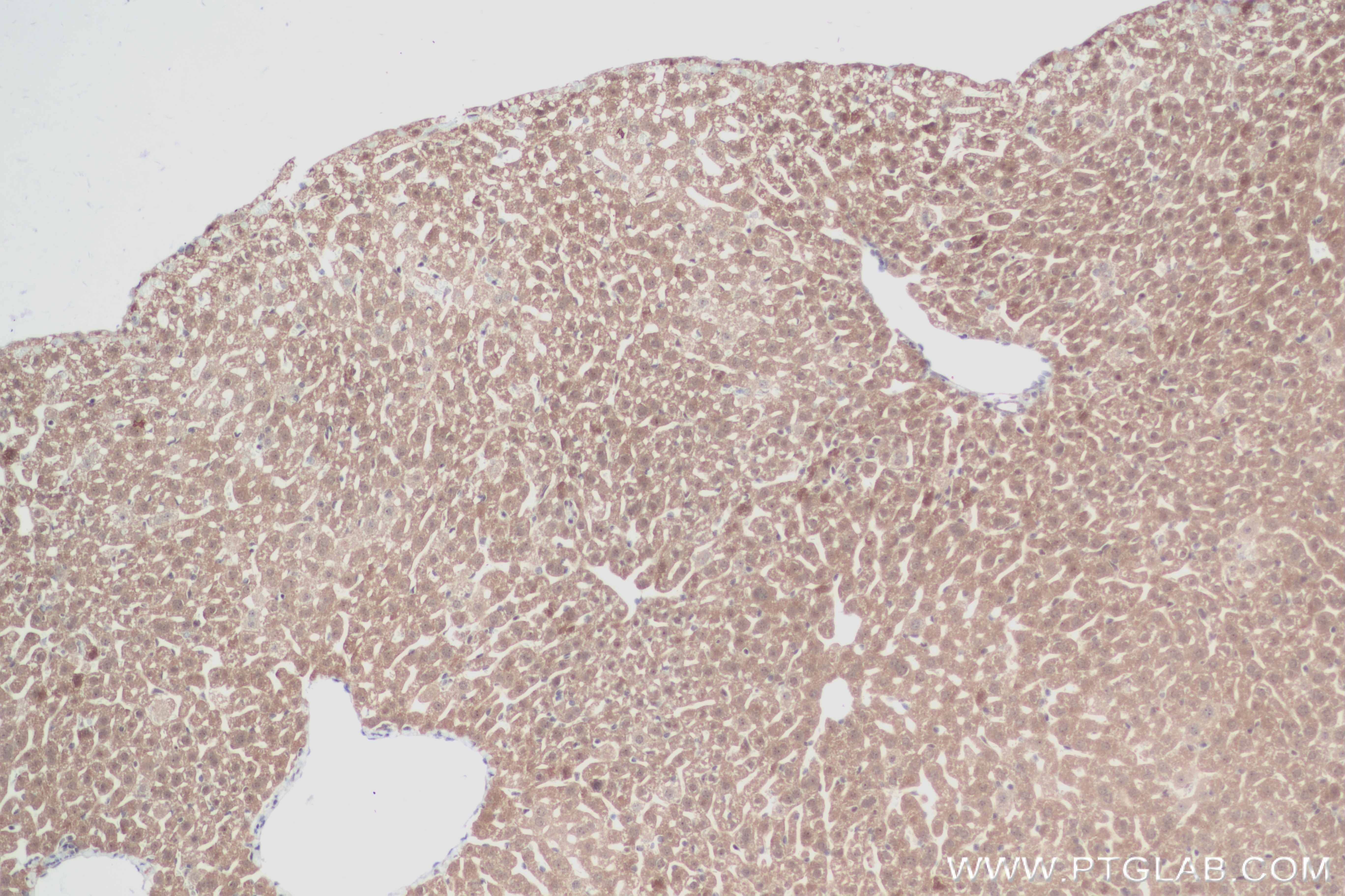 Immunohistochemistry (IHC) staining of mouse liver tissue using AGXT2L1 Recombinant antibody (83984-5-RR)