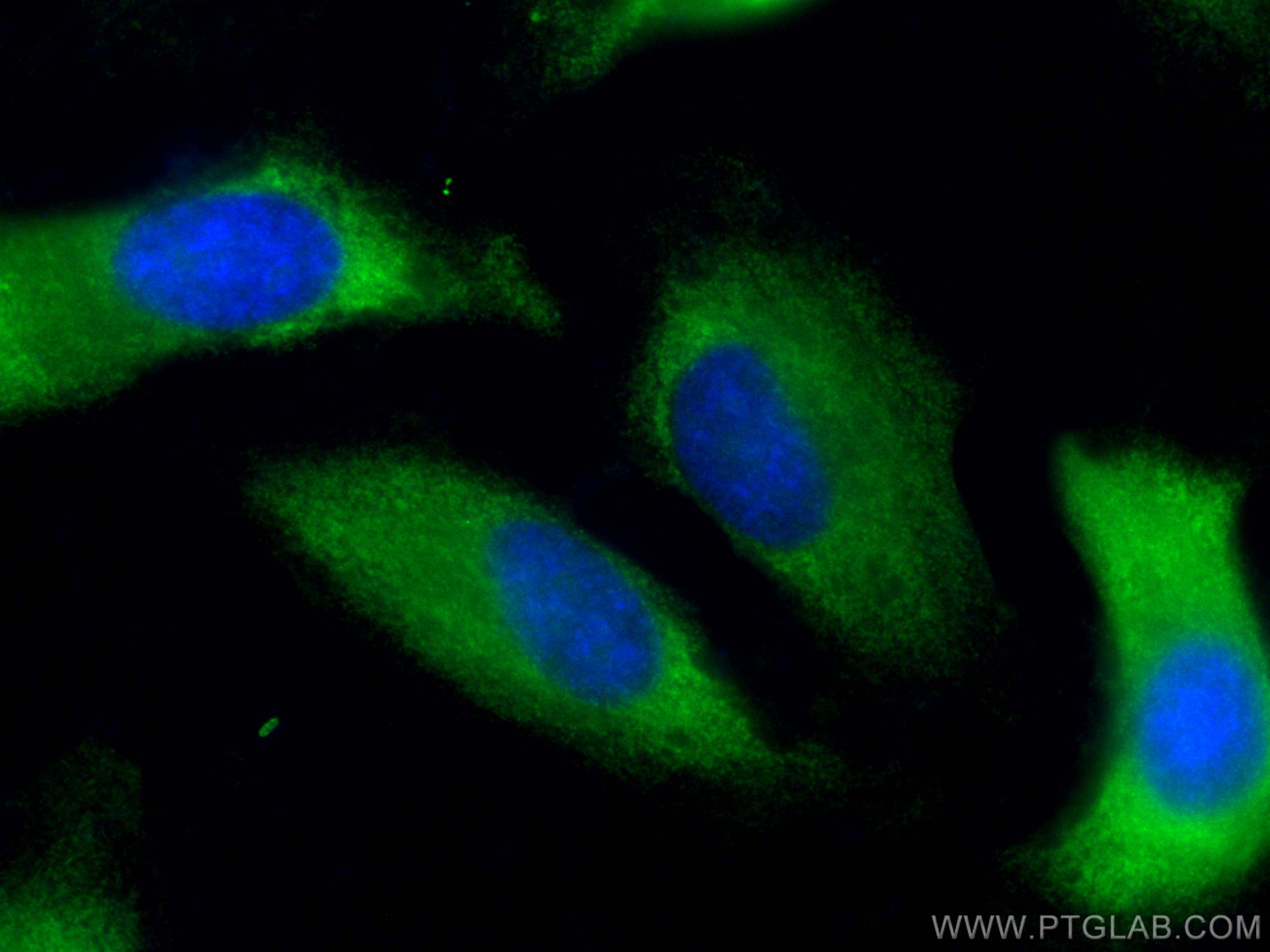 Immunofluorescence (IF) / fluorescent staining of HeLa cells using CoraLite® Plus 488-conjugated AHCYL1 Polyclonal an (CL488-10658)