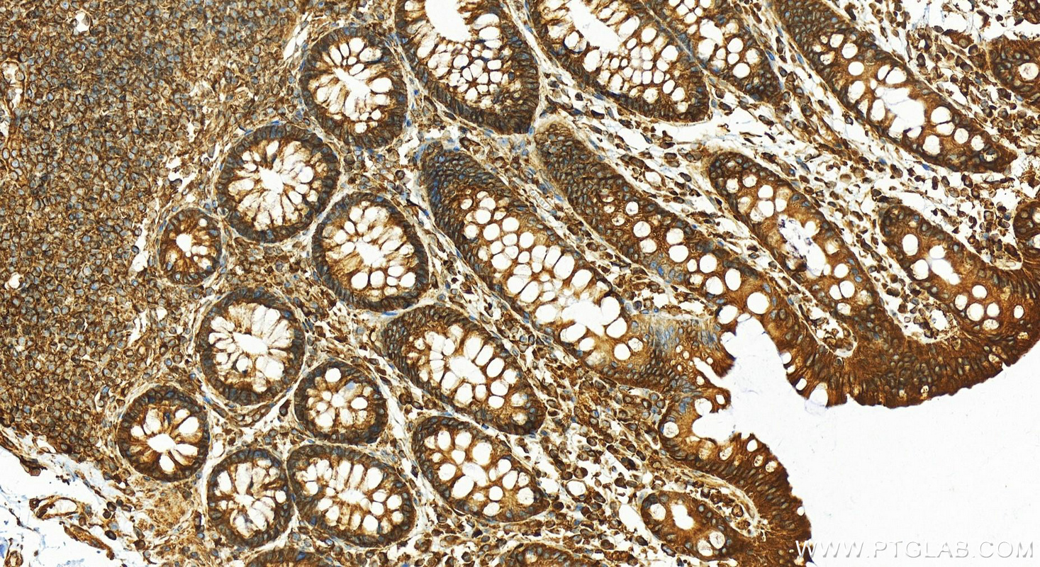 Immunohistochemistry (IHC) staining of human normal colon using AHNAK Polyclonal antibody (16637-1-AP)