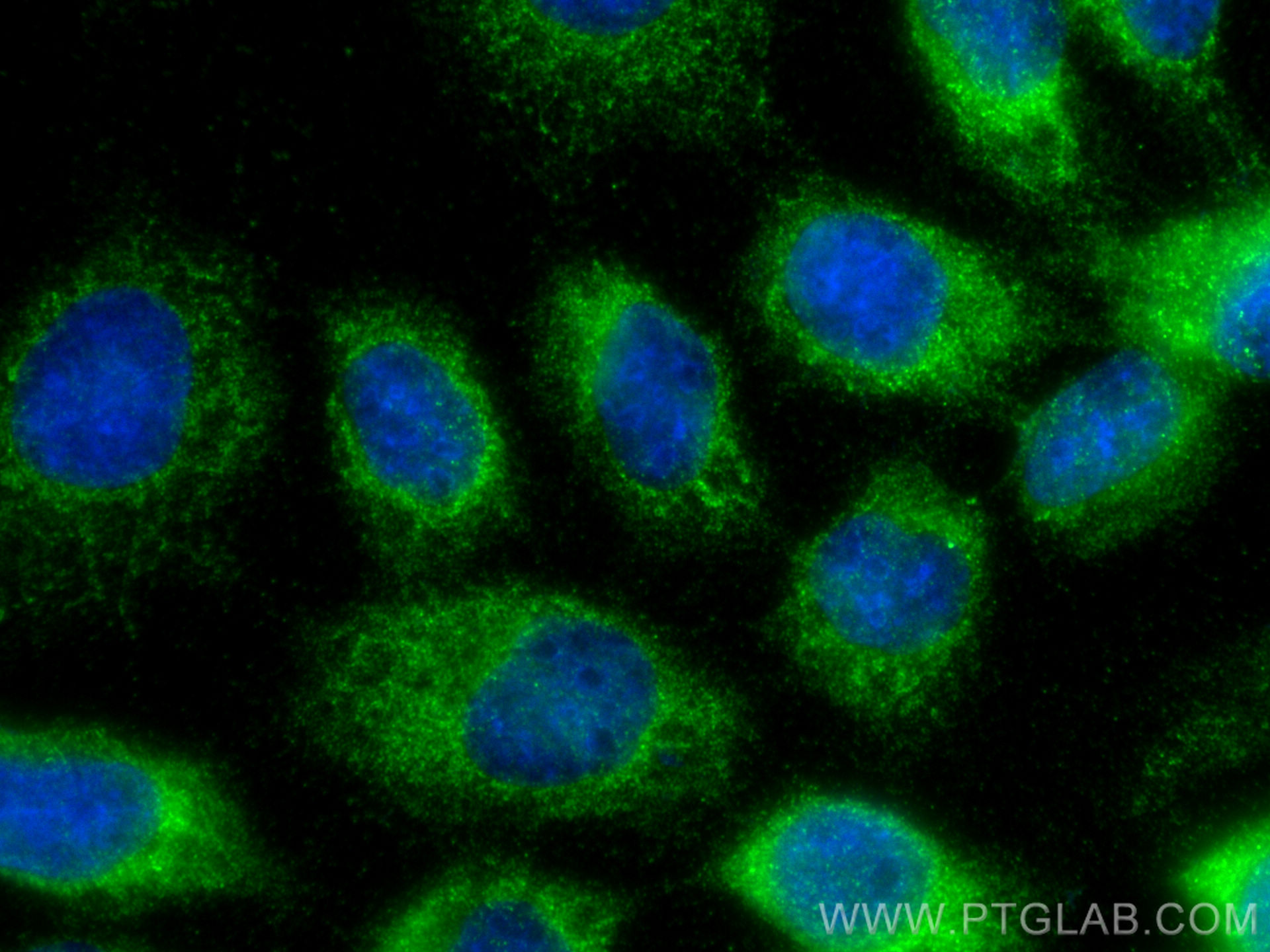 Immunofluorescence (IF) / fluorescent staining of A431 cells using AHR Polyclonal antibody (28727-1-AP)