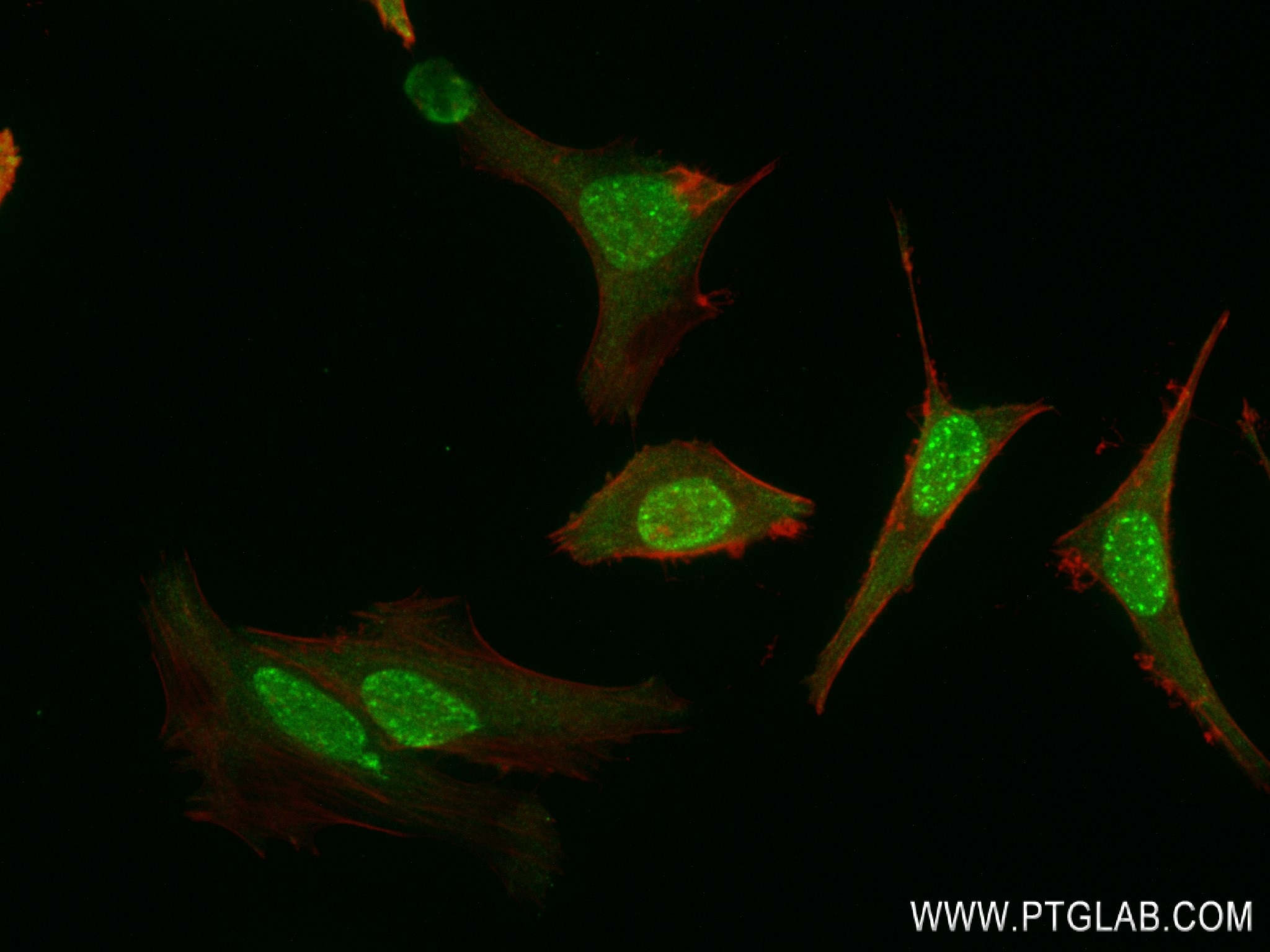 Immunofluorescence (IF) / fluorescent staining of HeLa cells using AHR Recombinant antibody (83369-6-RR)