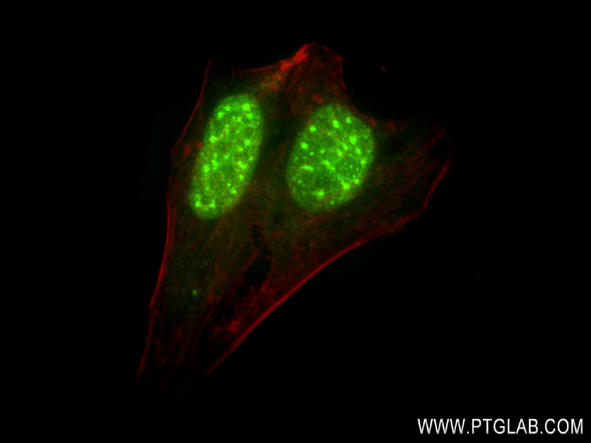 Immunofluorescence (IF) / fluorescent staining of HeLa cells using AHR Recombinant antibody (83369-6-RR)