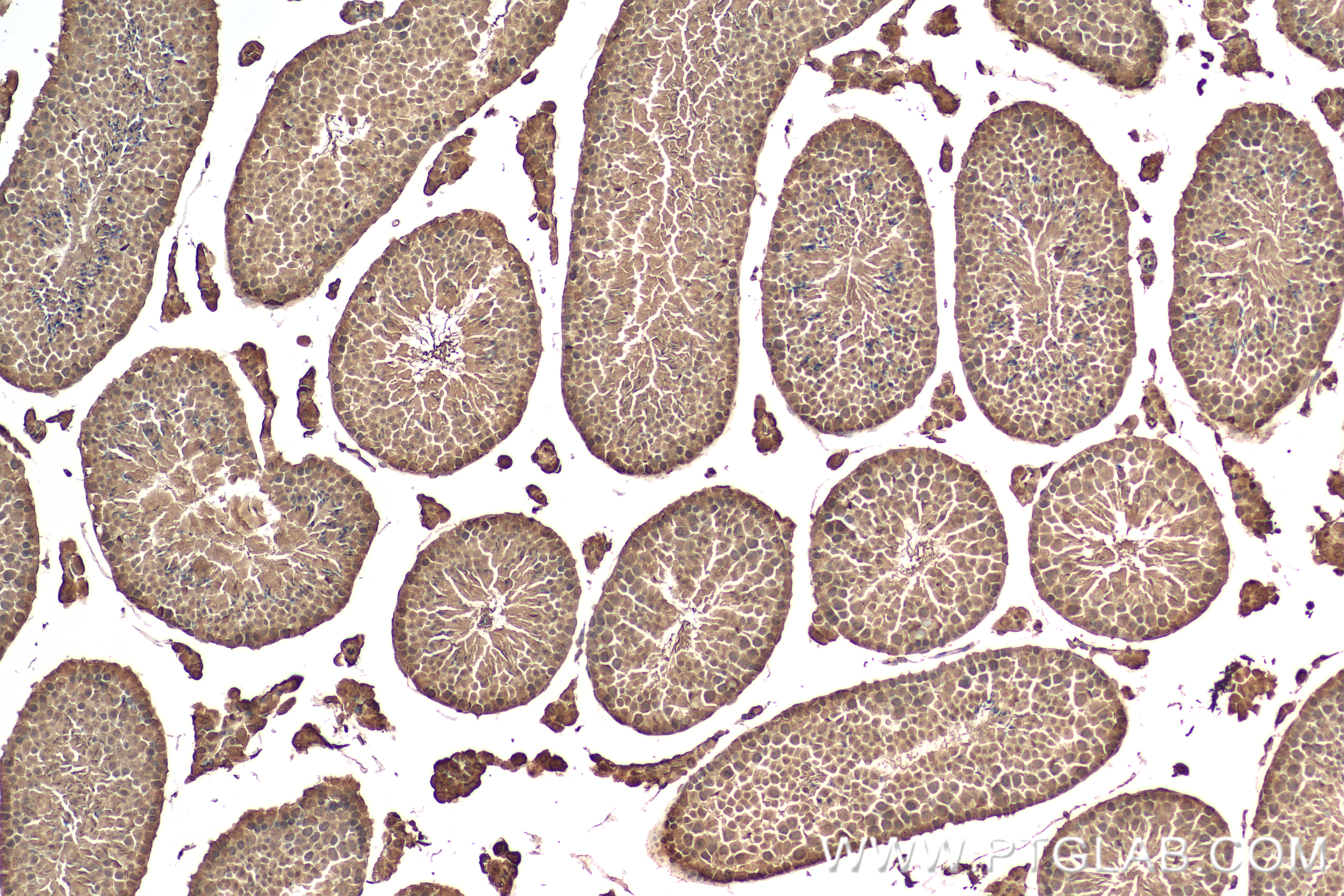 Immunohistochemistry (IHC) staining of mouse testis tissue using AHR Recombinant antibody (83369-6-RR)