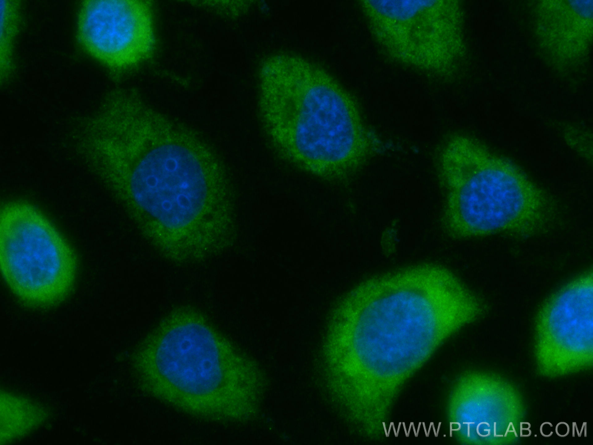 Immunofluorescence (IF) / fluorescent staining of A431 cells using CoraLite® Plus 488-conjugated AHR Polyclonal antib (CL488-28727)