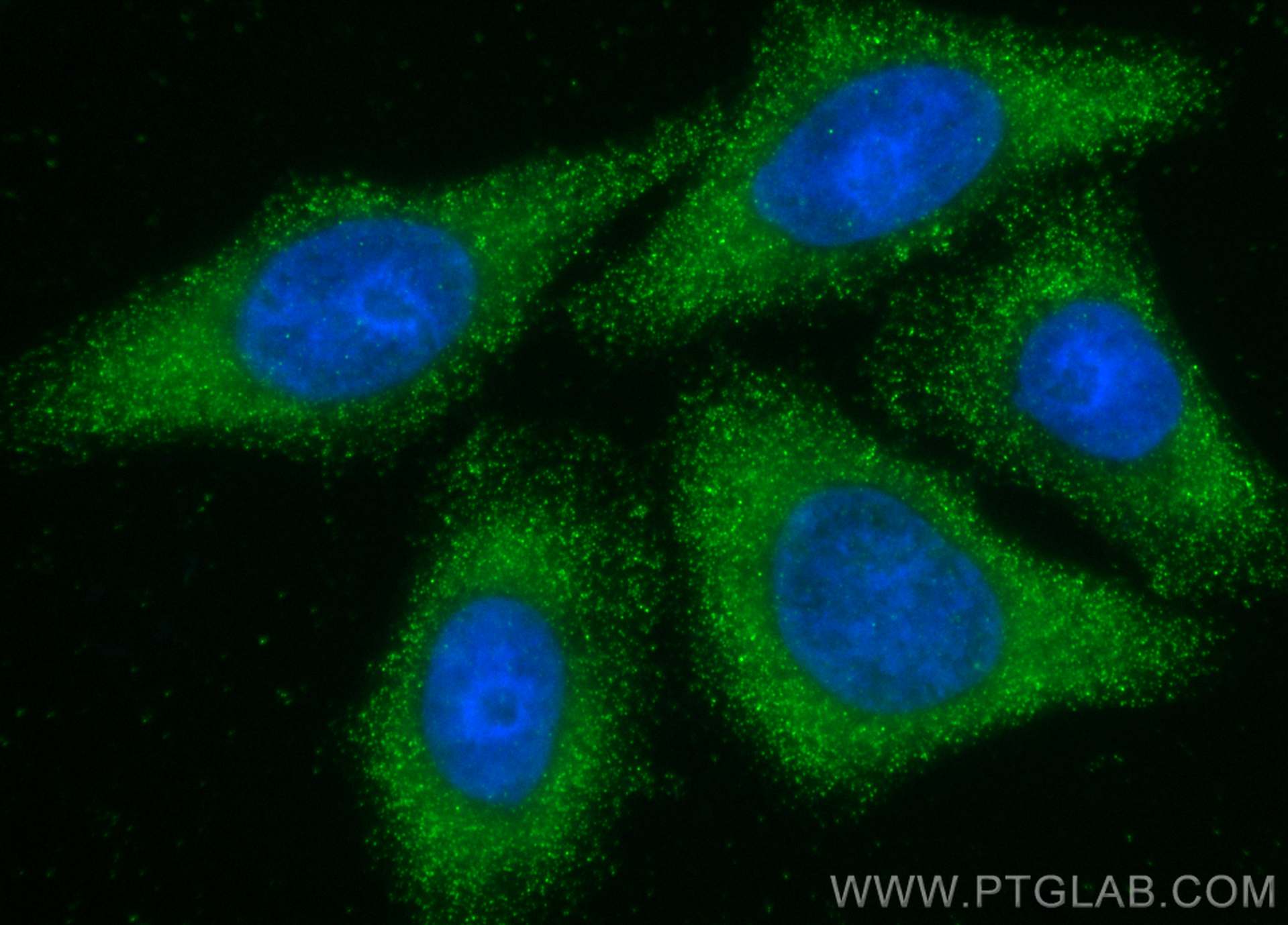 Immunofluorescence (IF) / fluorescent staining of HepG2 cells using Fetuin-A/AHSG Monoclonal antibody (66094-1-Ig)