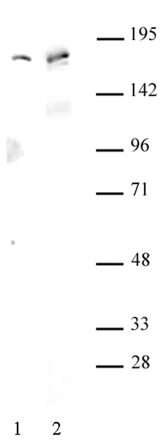 AIB1 antibody (pAb) tested by Western blot. Detection of AIB1 by Western blot. Lane 1: HeLa whole-cell extract (30 ug). Lane 2: Whole cell extract (30 ug) of MCF-7 cells. Both probed with AIB1 antibody at a 1:500 dilution.