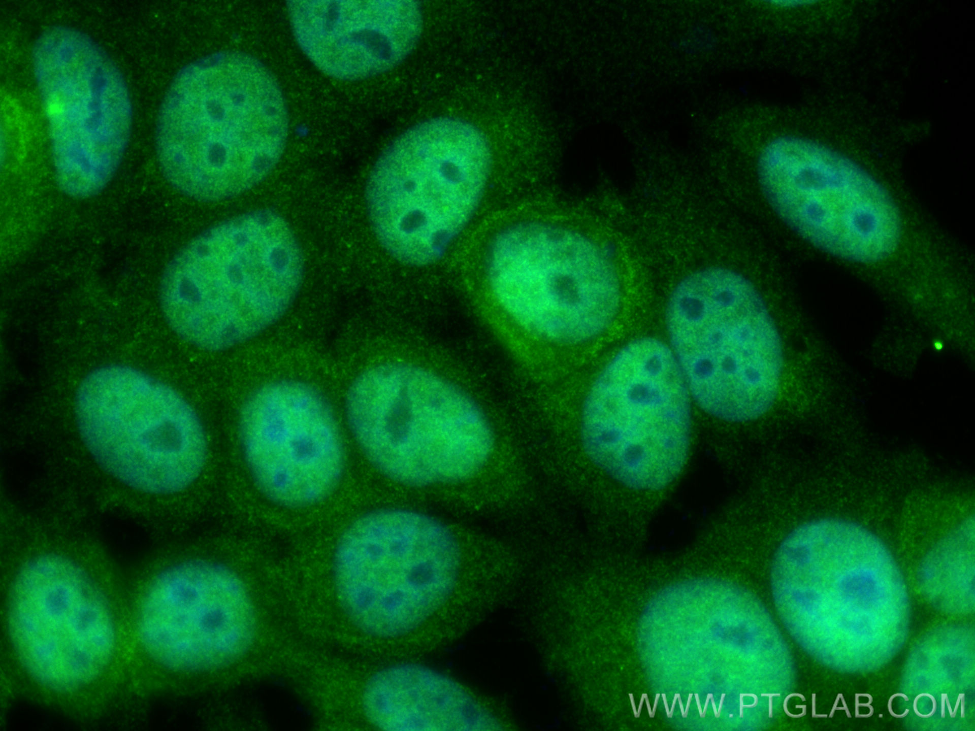 Immunofluorescence (IF) / fluorescent staining of MCF-7 cells using AIM2 Polyclonal antibody (20590-1-AP)