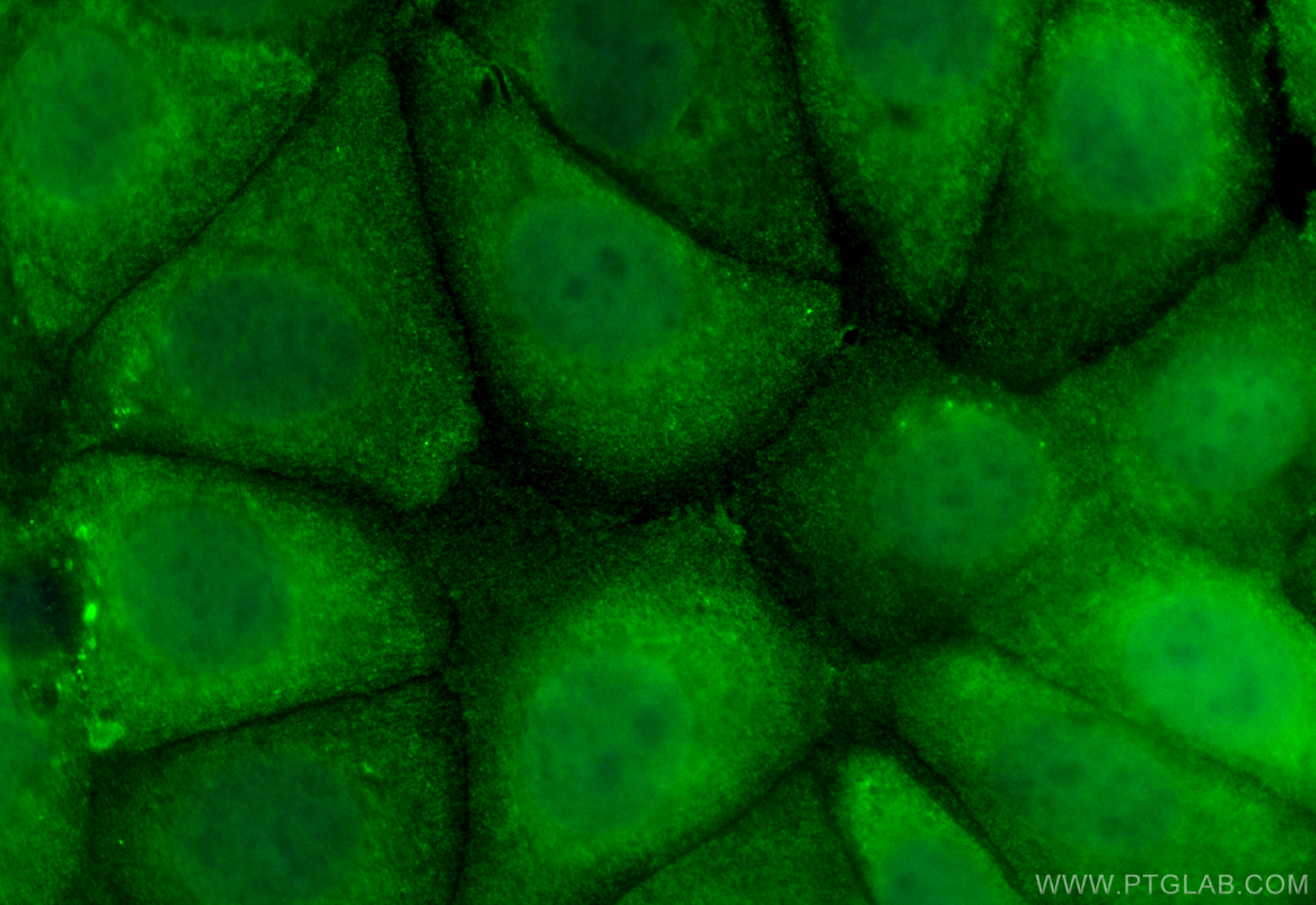 Immunofluorescence (IF) / fluorescent staining of MCF-7 cells using CoraLite® Plus 488-conjugated AIM2 Monoclonal anti (CL488-66902)
