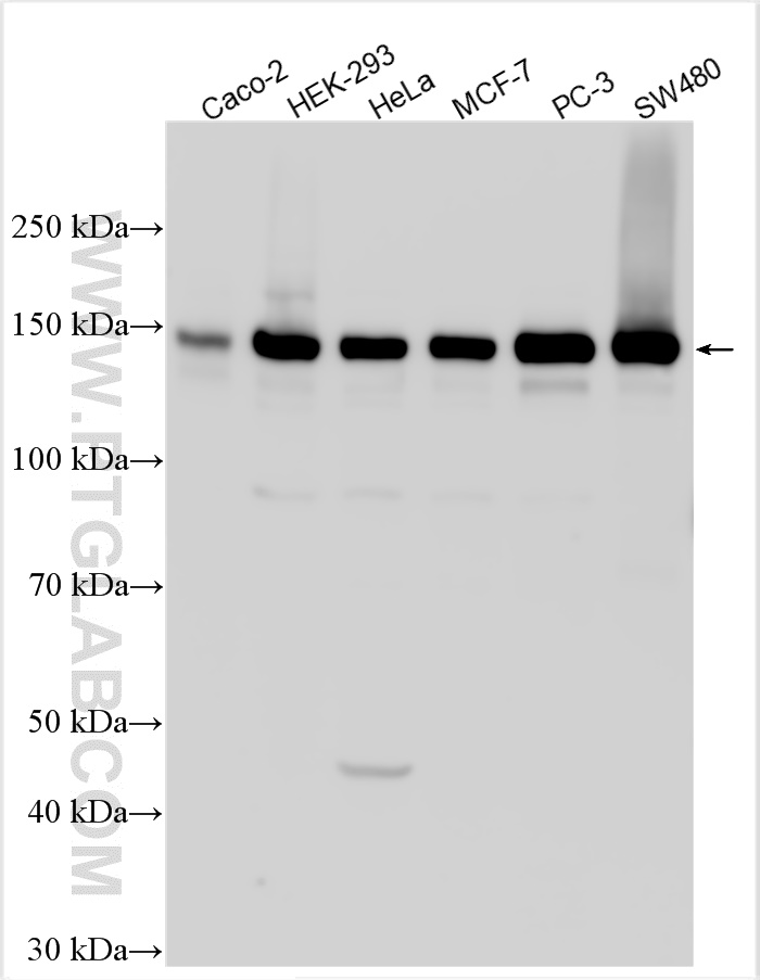 Western Blot (WB) analysis of various lysates using AKAP1 Polyclonal antibody (15618-1-AP)