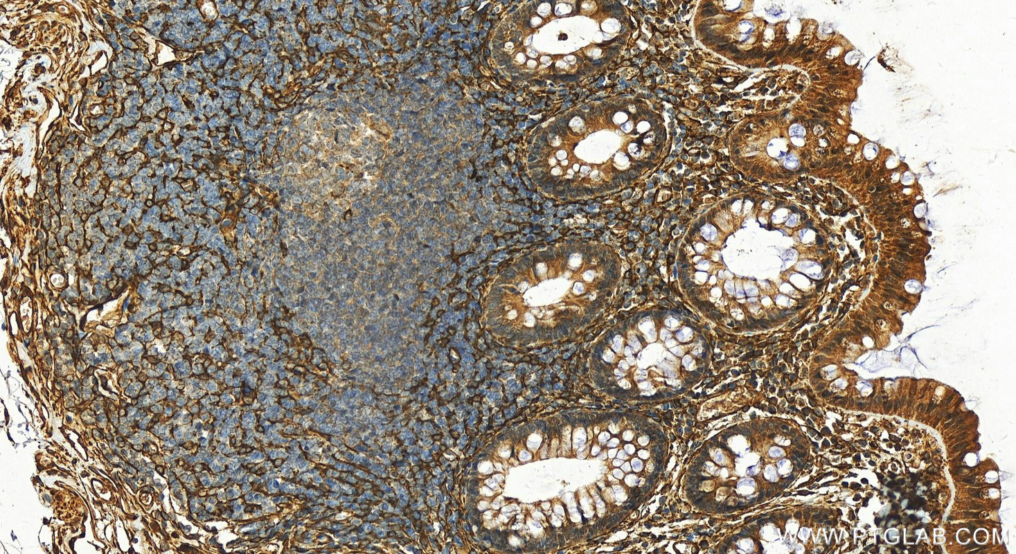 Immunohistochemistry (IHC) staining of human normal colon using AKAP12 Polyclonal antibody (25199-1-AP)