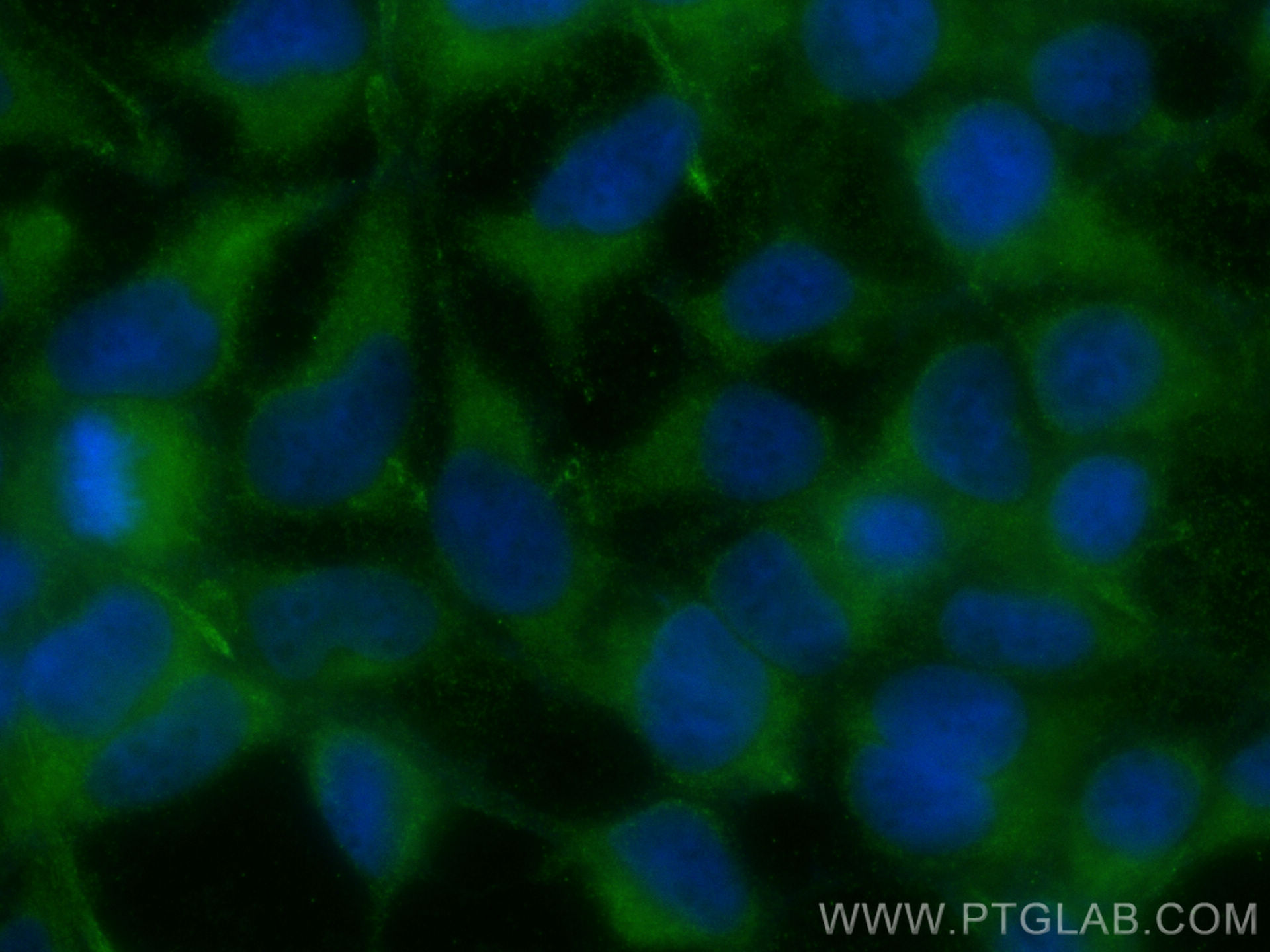 Immunofluorescence (IF) / fluorescent staining of HEK-293 cells using AKD1 Polyclonal antibody (23042-1-AP)