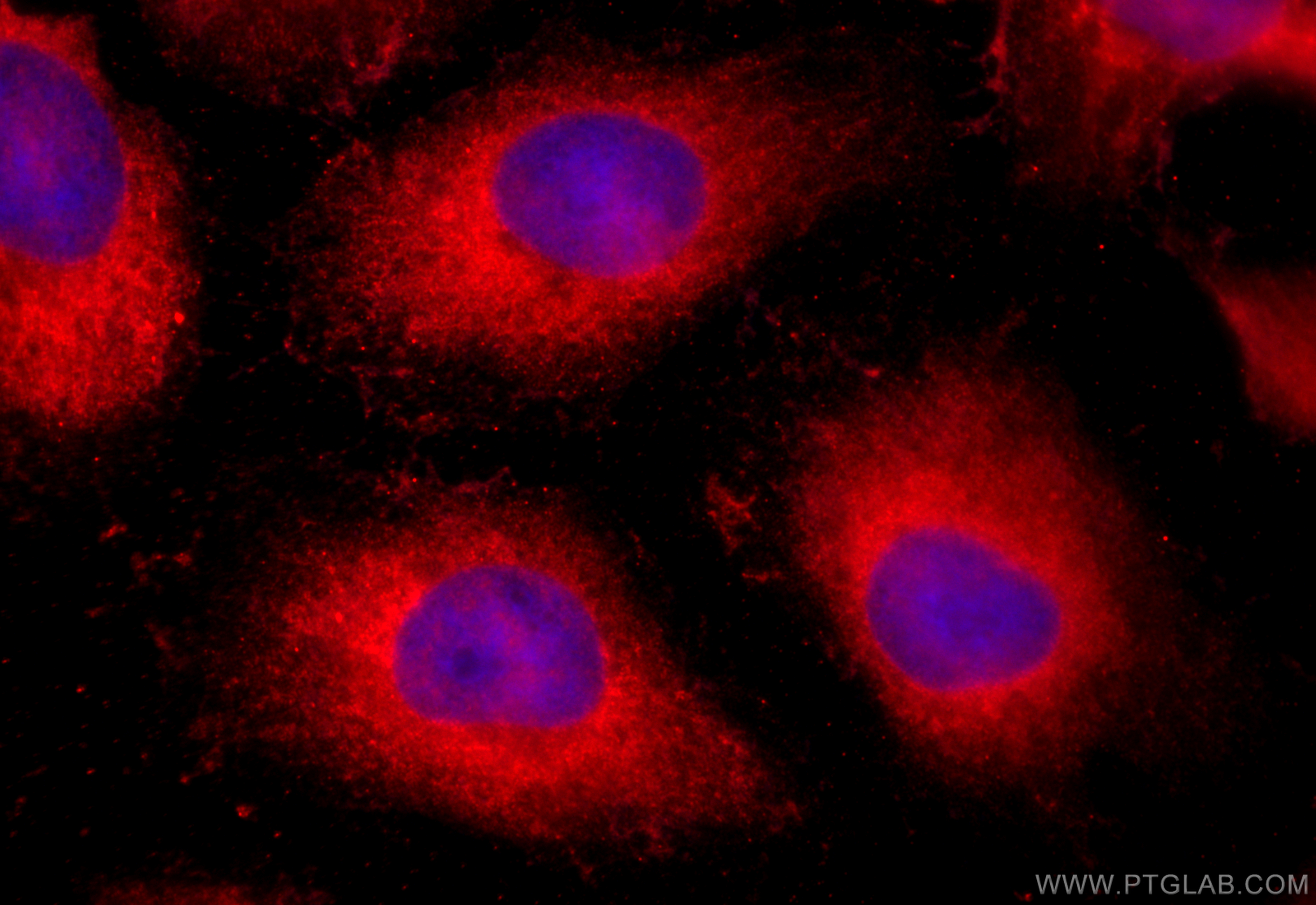 Immunofluorescence (IF) / fluorescent staining of HeLa cells using AKR1CL2 Polyclonal antibody (20525-1-AP)