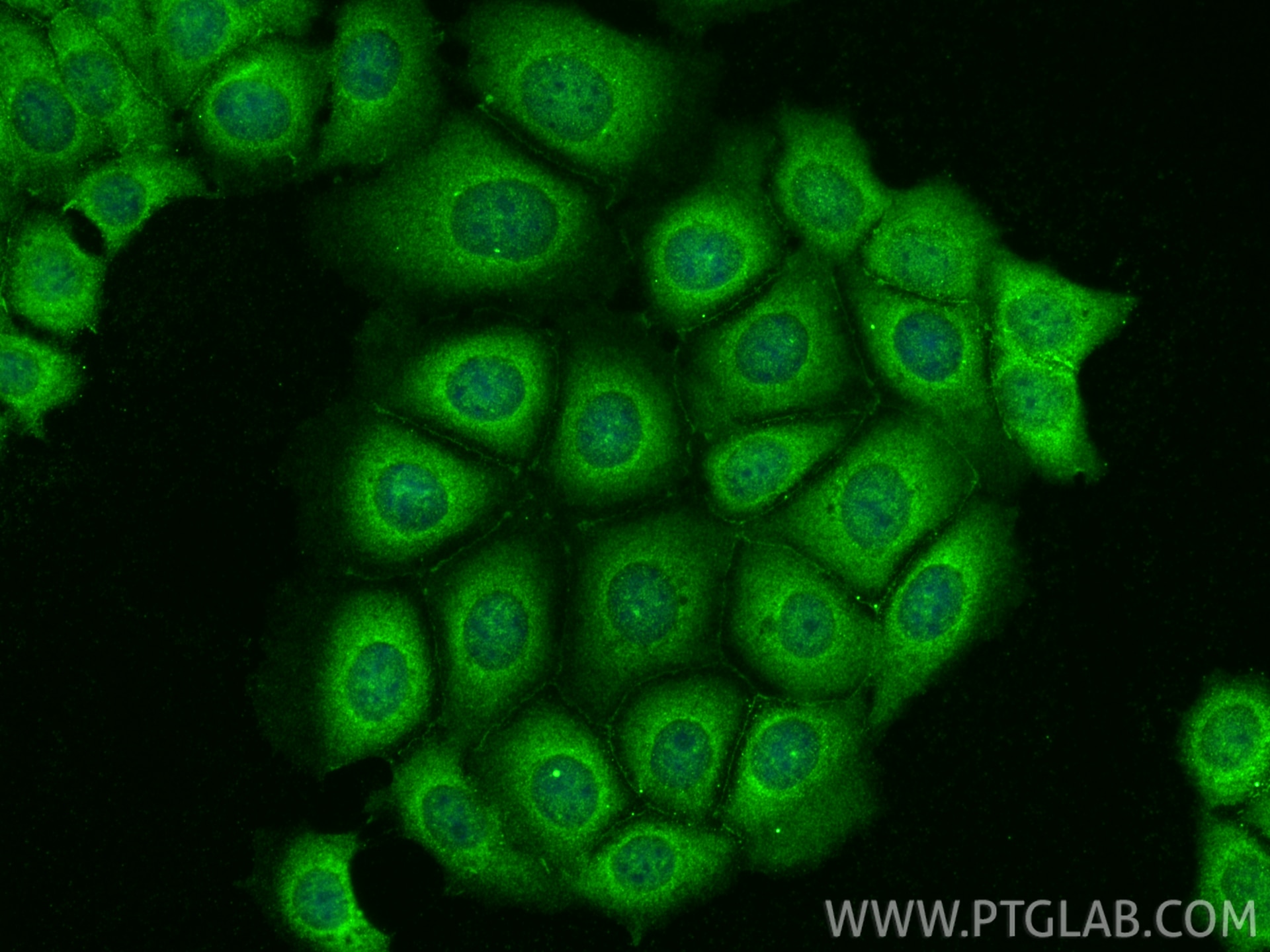 Immunofluorescence (IF) / fluorescent staining of MCF-7 cells using AKT Polyclonal antibody (10176-2-AP)