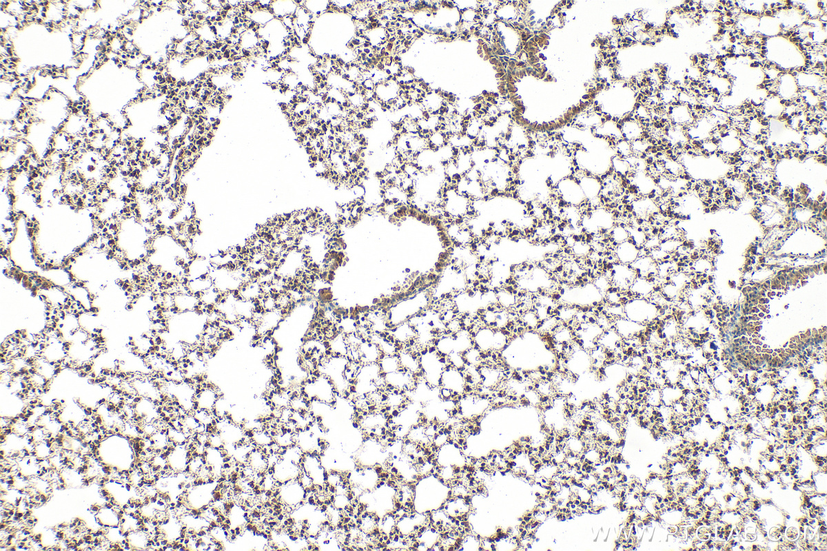 Immunohistochemistry (IHC) staining of mouse lung tissue using AKT Monoclonal antibody (60203-2-Ig)